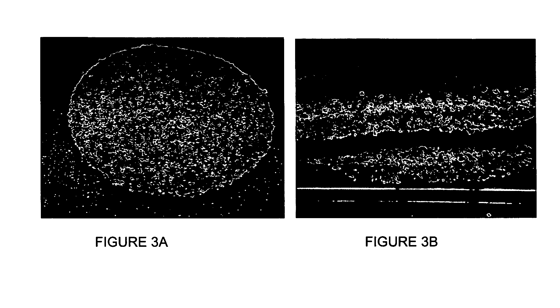 Methods for making and using composites, polymer scaffolds, and composite scaffolds