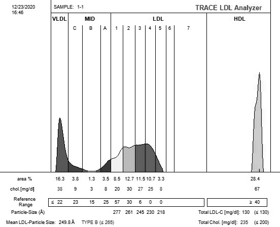 Sudan black b2 dye and staining solution, detection method using same, gel electrophoresis system containing same, kit and preparation method