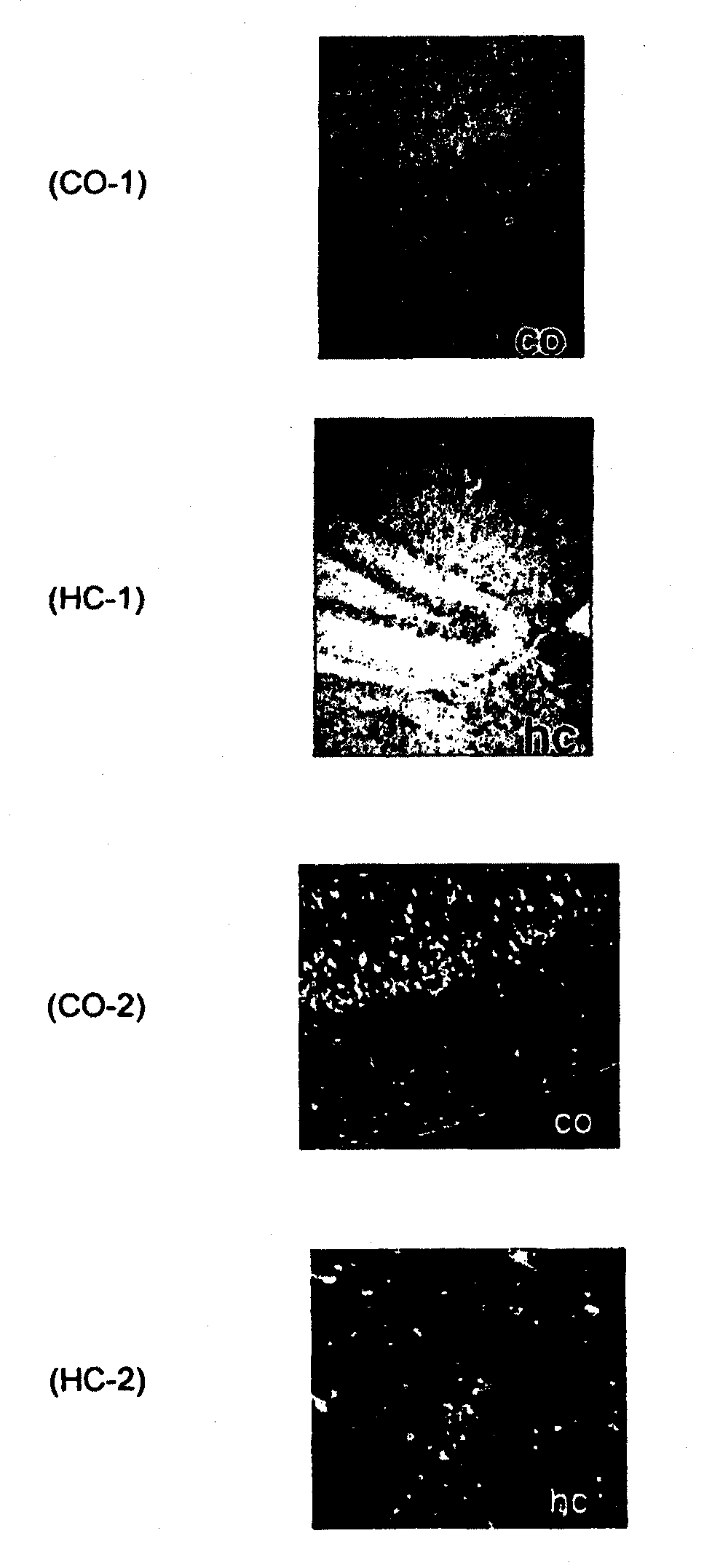 Ligands for aggregated tau molecules