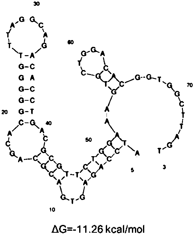 Nucleic acid aptamer capable of specifically recognizing vimentin and application thereof