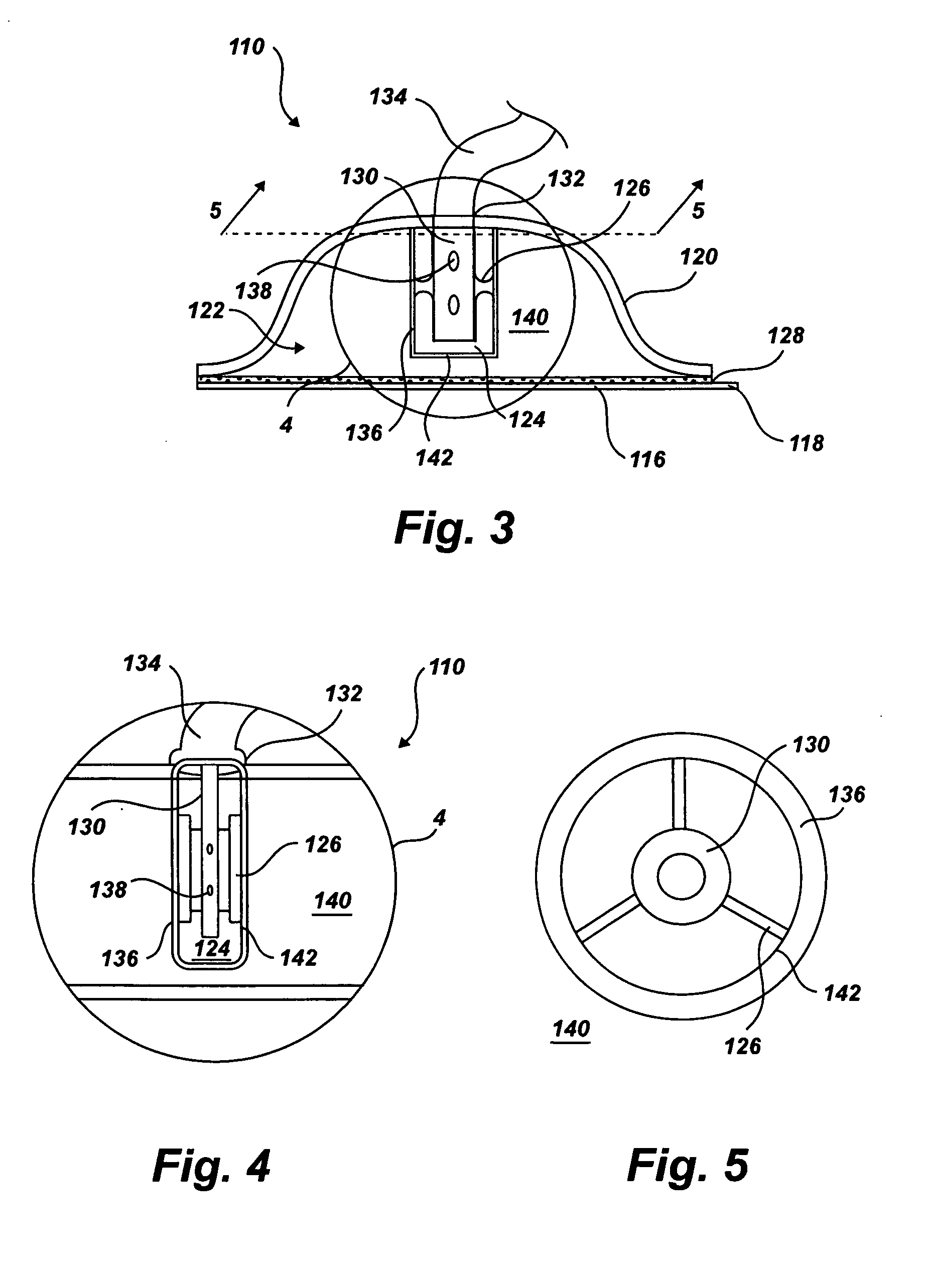Device and method for wound therapy