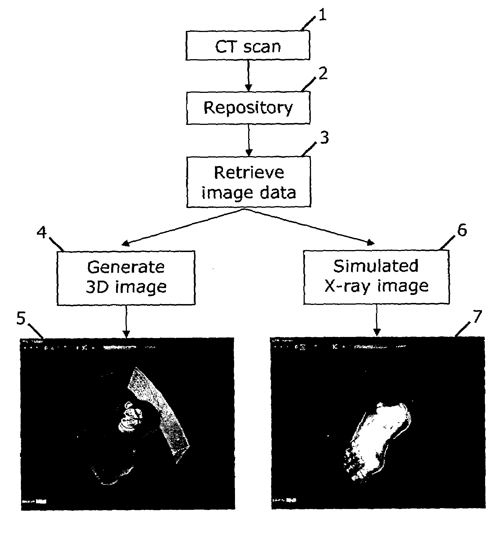 Method and system for simulating X-ray images