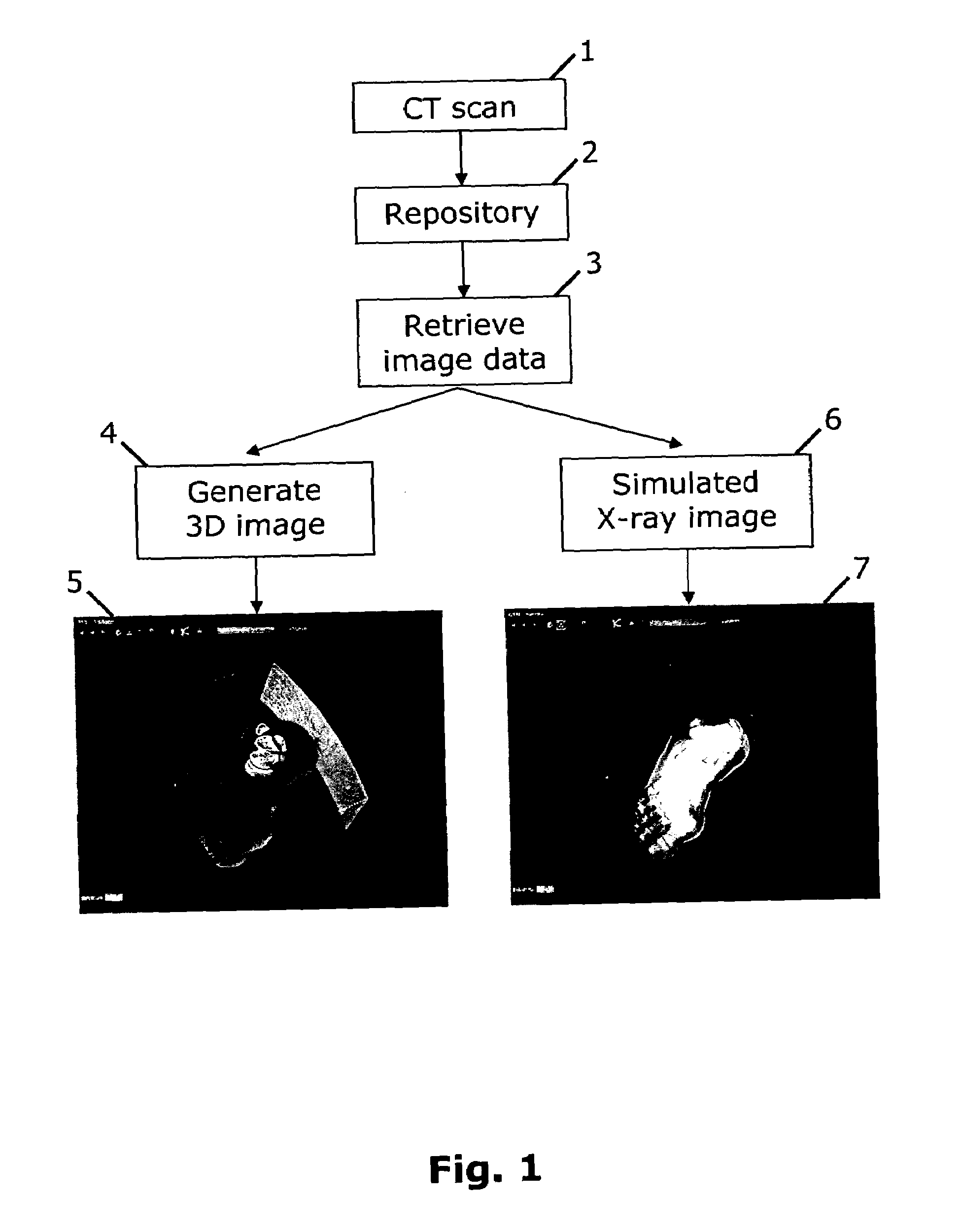 Method and system for simulating X-ray images