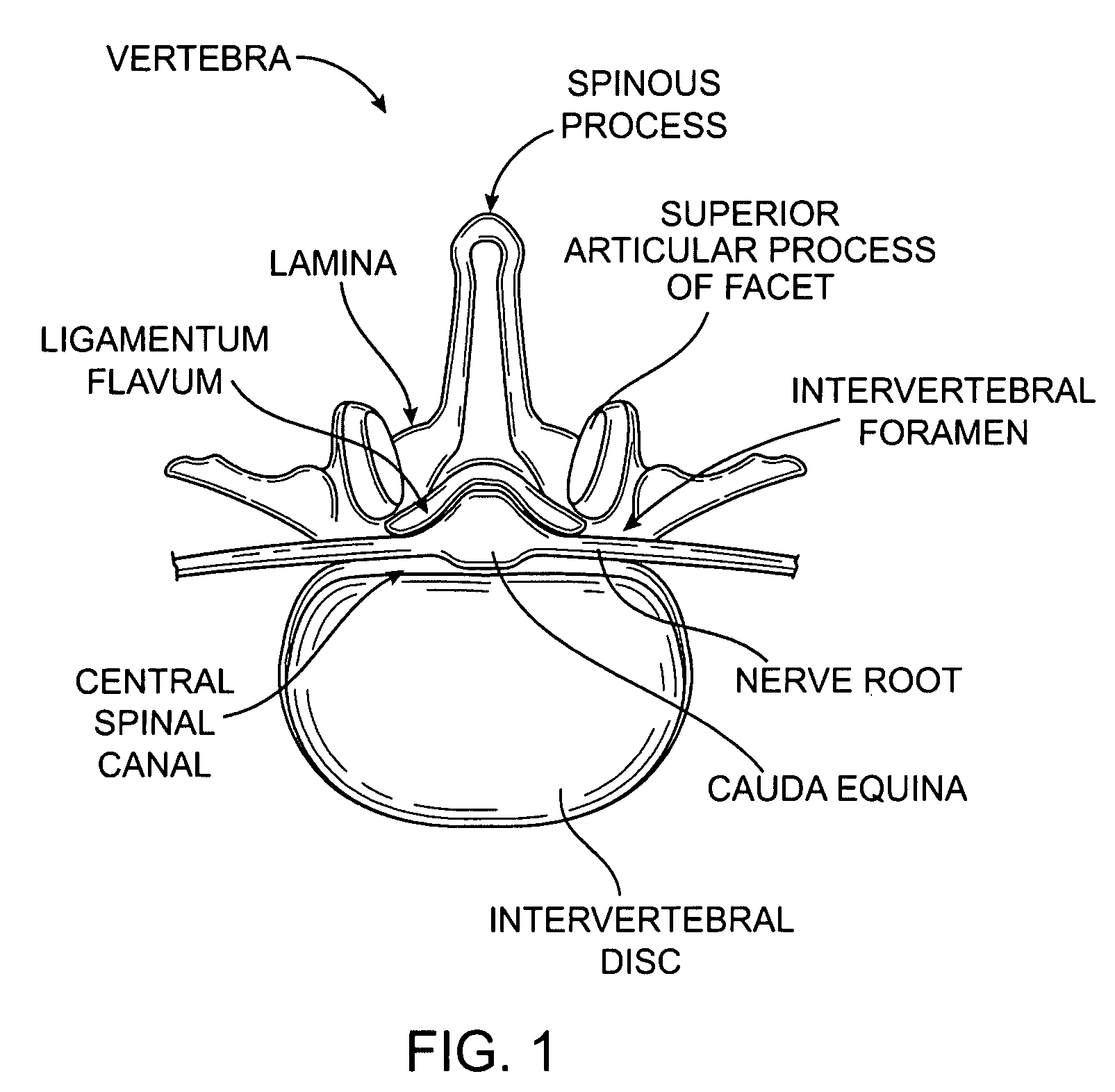 Tissue removal with at least partially flexible devices