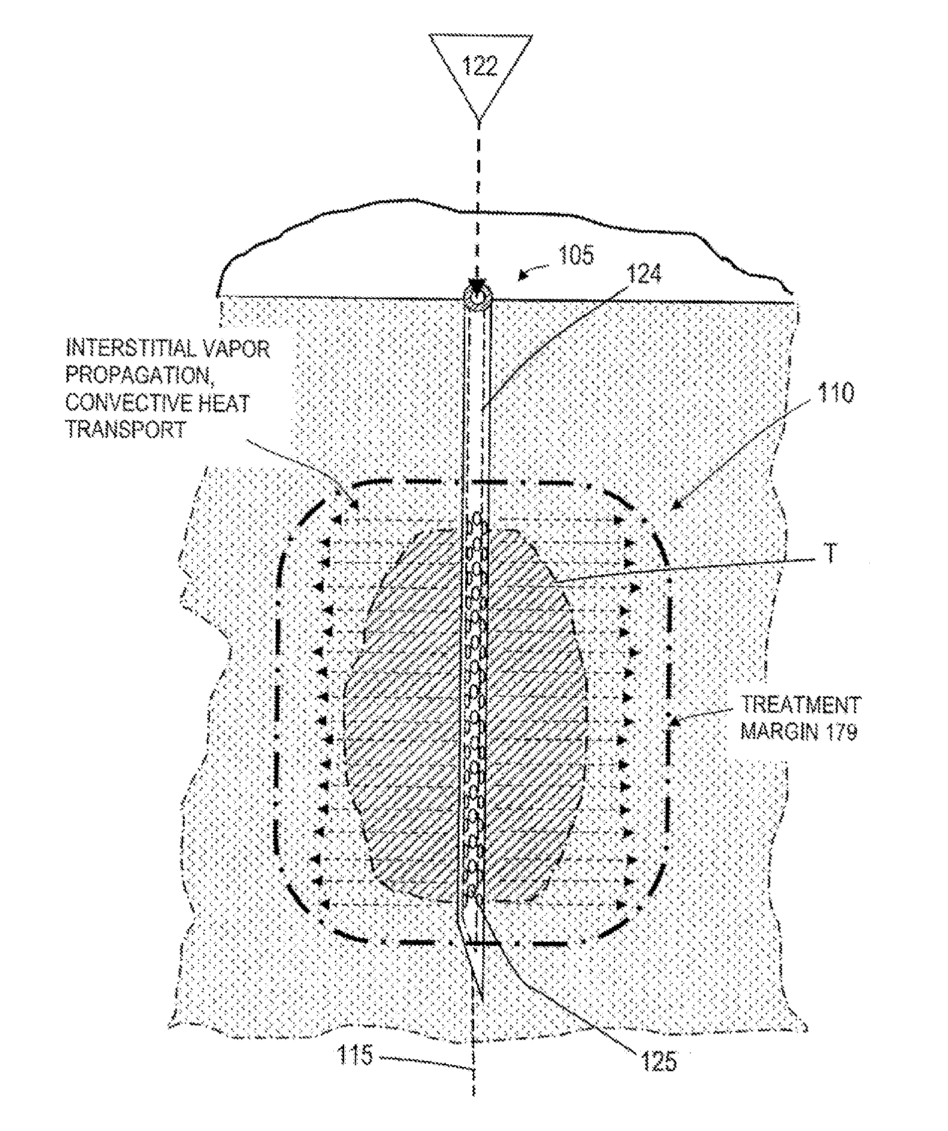 Medical systems and methods for ablating and absorbing tissue