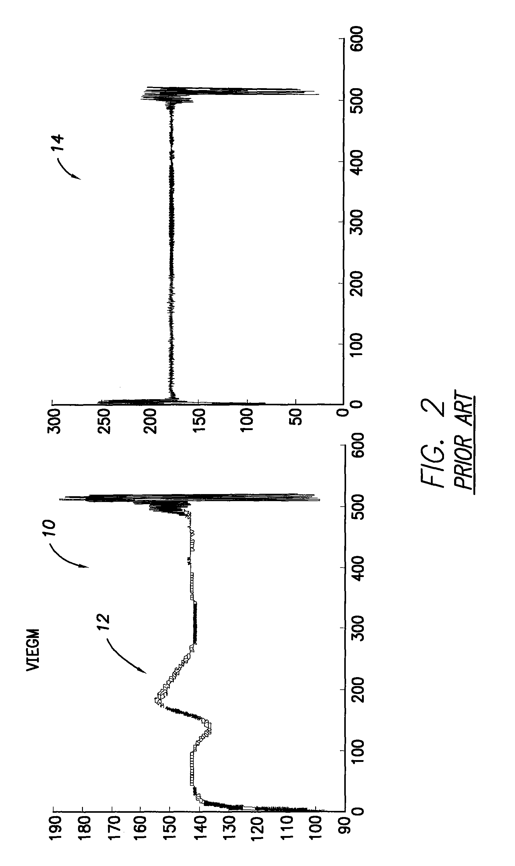 Systems and methods for employing multiple filters to detect T-wave oversensing and to improve tachyarrhythmia detection within an implantable medical device