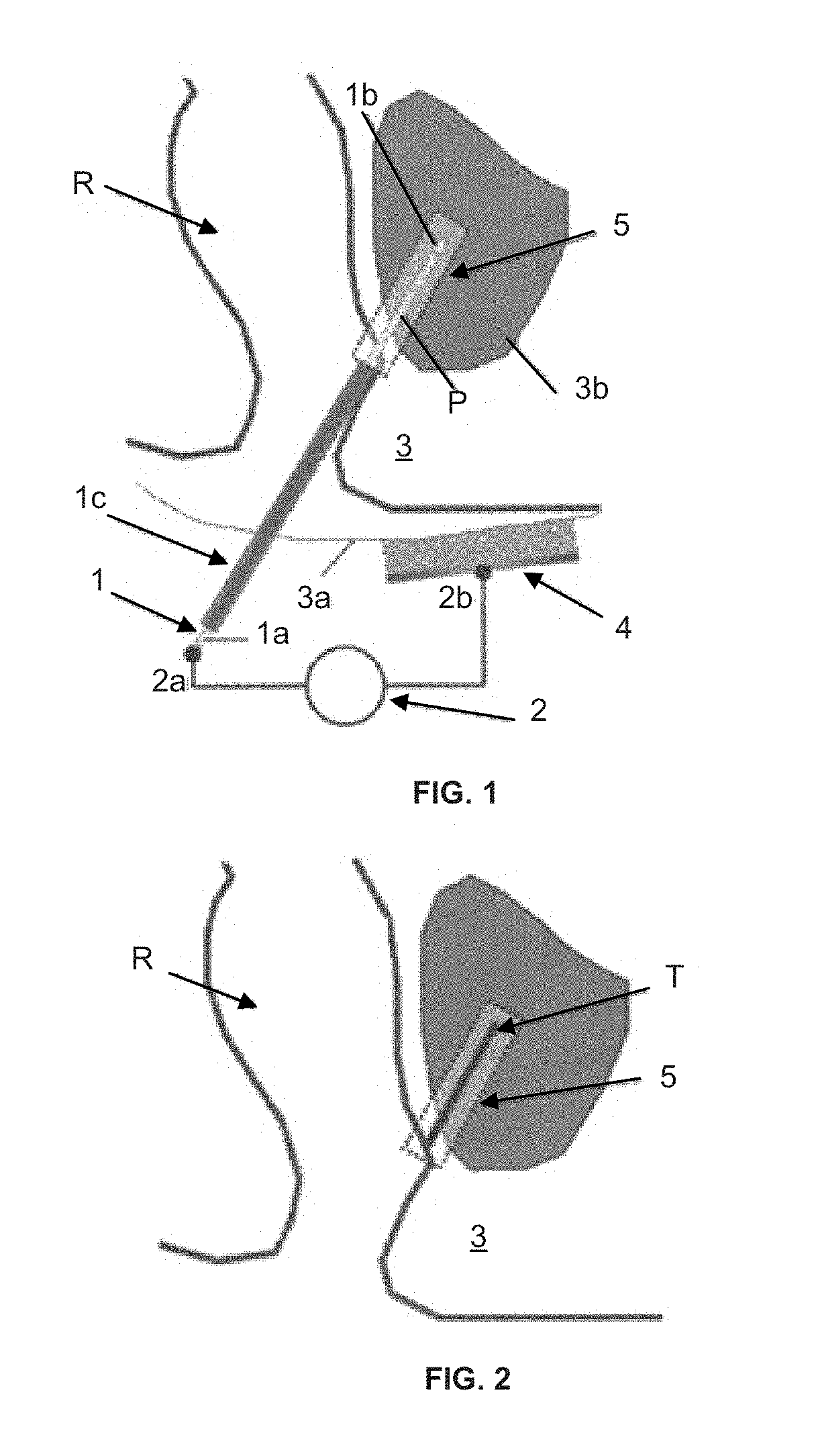 System for preventing bacterial infections in needle trajectories