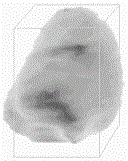 dvh graph parallel statistical method based on cuda stream and shared memory