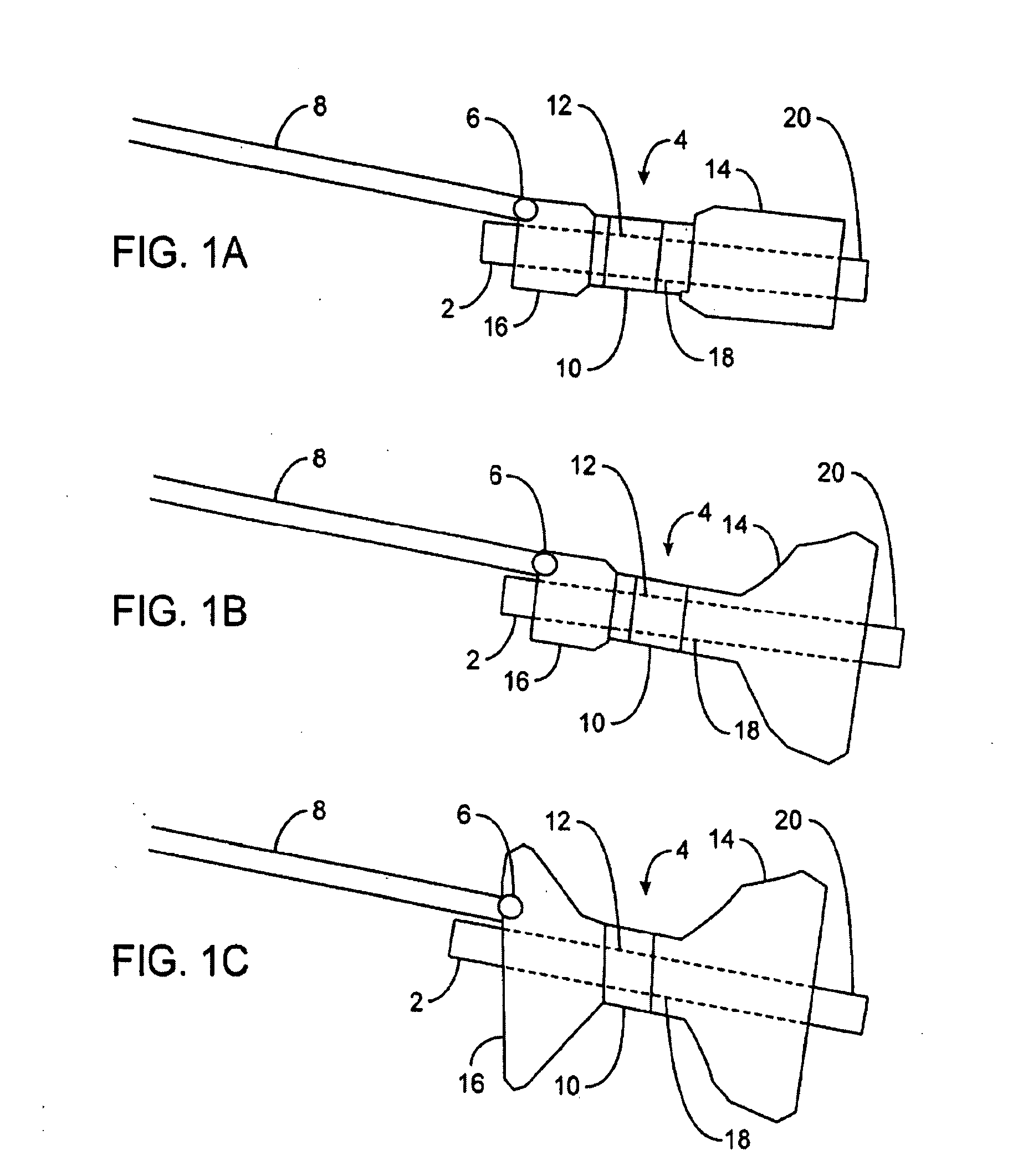 Gastric retaining devices and methods