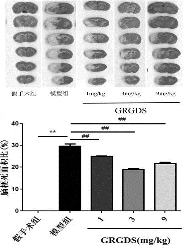 Active oligopeptide GRGDS and application thereof in preparation of drug for preventing and treating ischemic cerebrovascular diseases