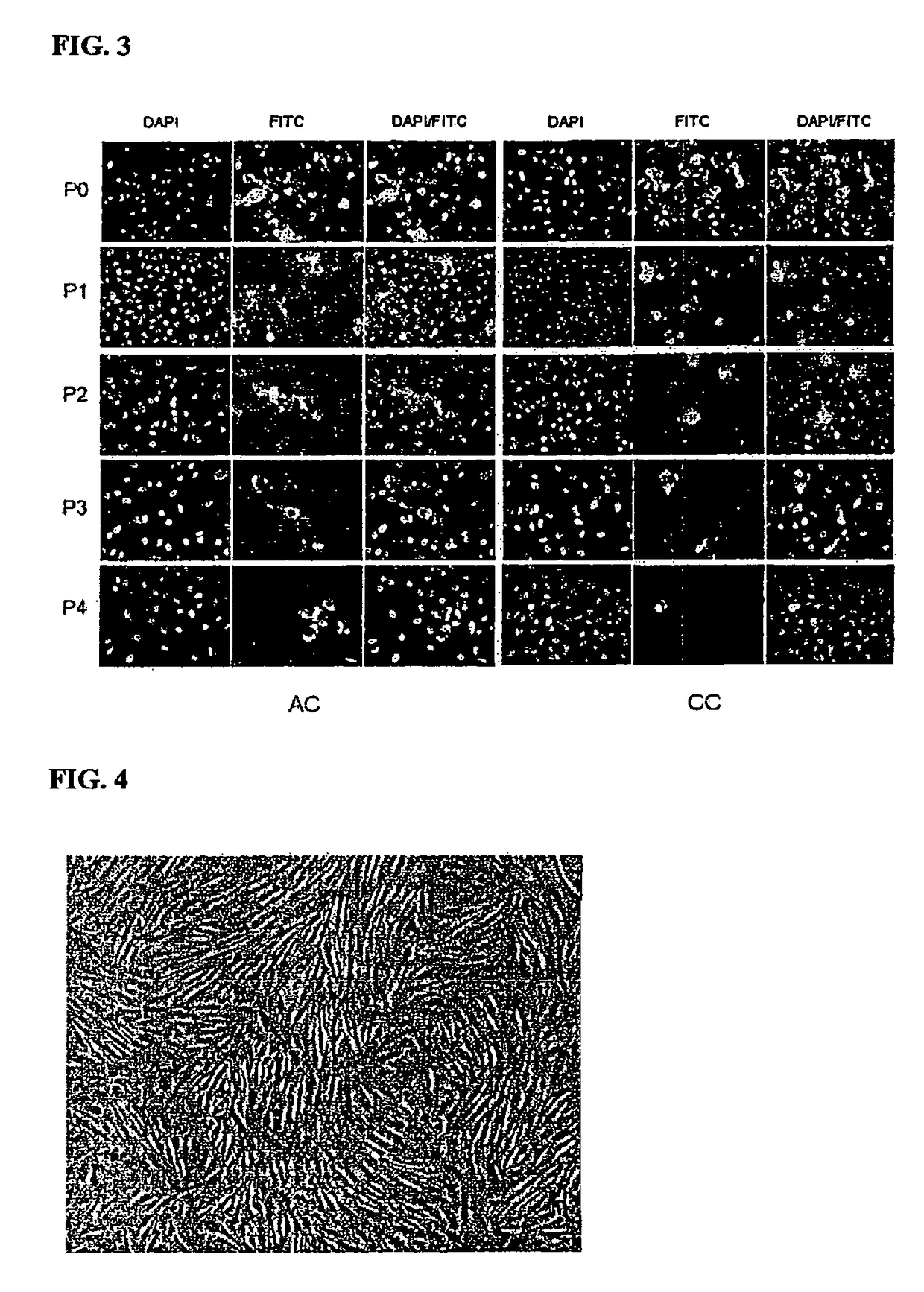 Artificial cartilage containing chondrocytes obtained from costal cartilage and preparation process thereof