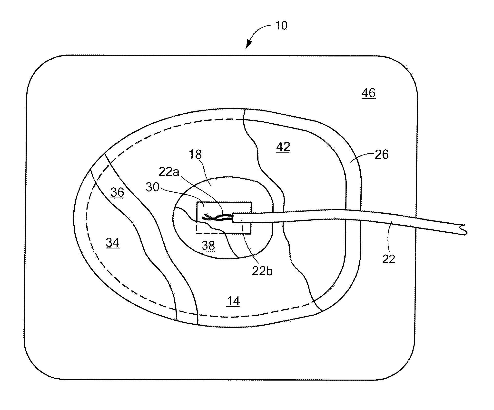 Apparatus and method for energy distribution in a medical electrode