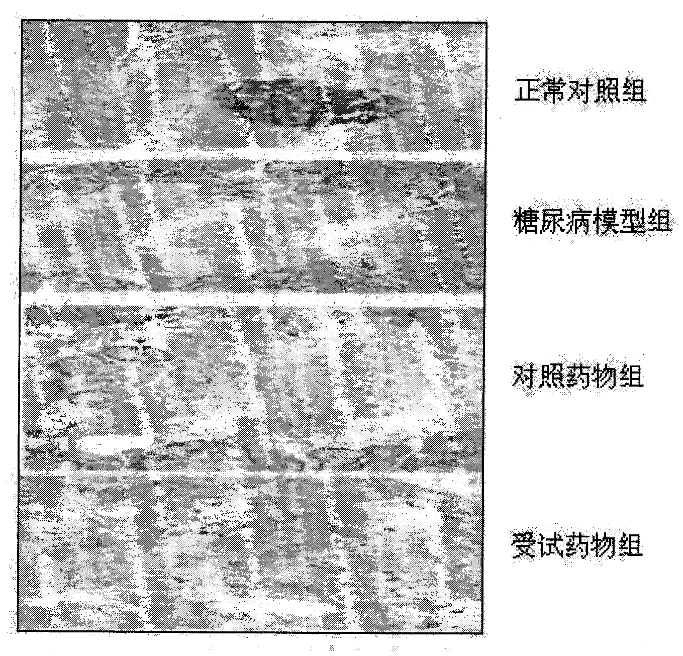 Healthcare product or medicine for preventing diabetes complication and senium and preparation method thereof