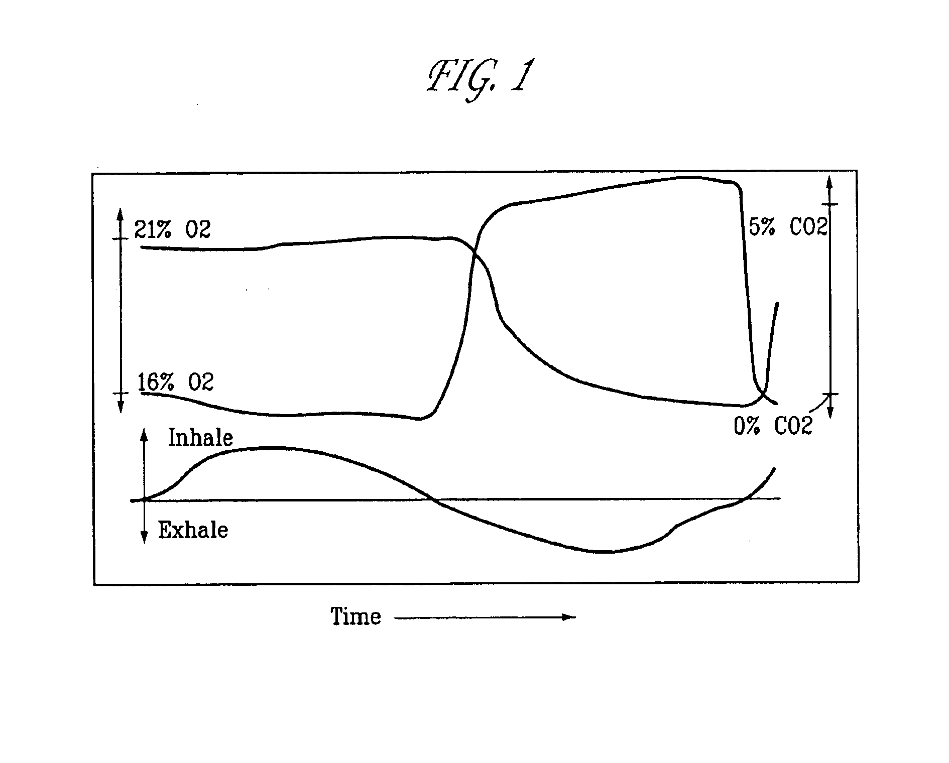 Method and apparatus for estimation of resting respiratory quotient