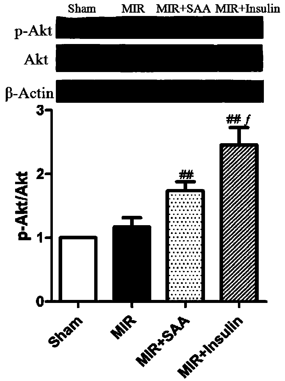 Application of amygdalin in protecting ischemic heart