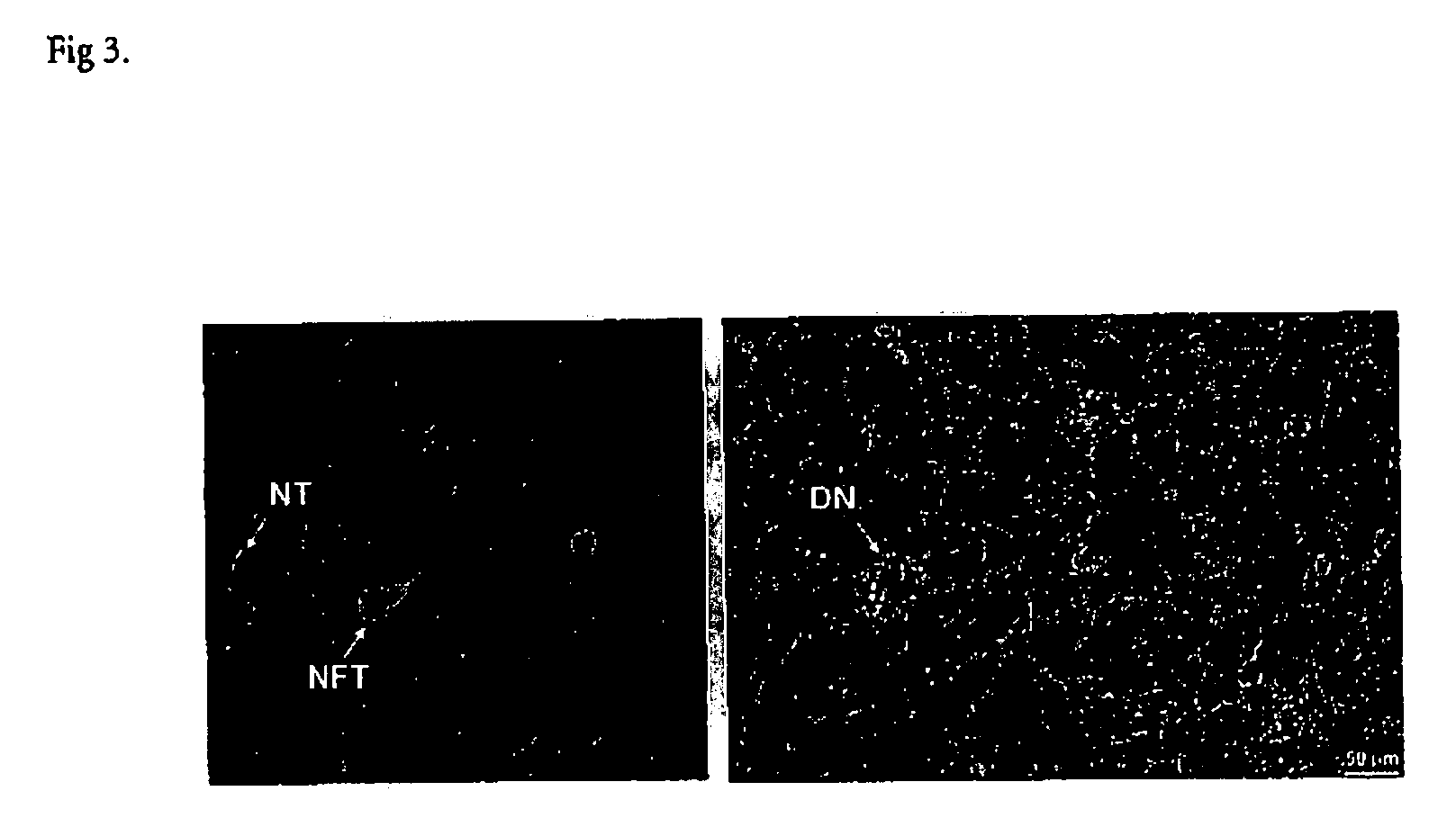 Antibody that recognizes phosphorylated peptides