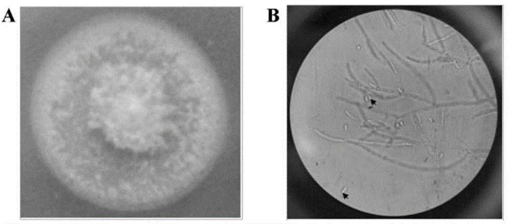 Agrobacterium tumefaciens-mediated tuber melanosporum genetic transformation method