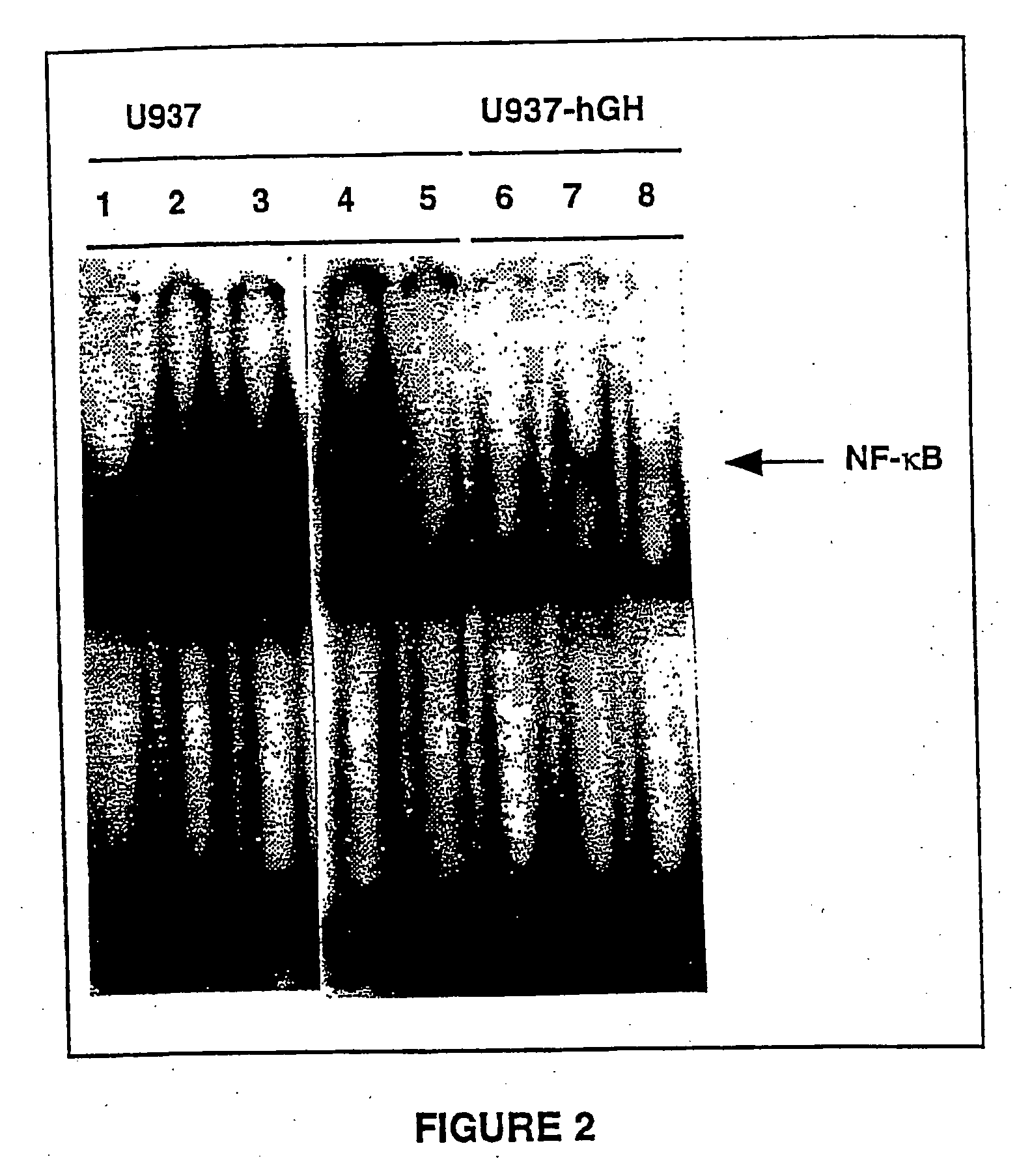 NF-kappaB activation inhibitors, and their pharmaceutical uses