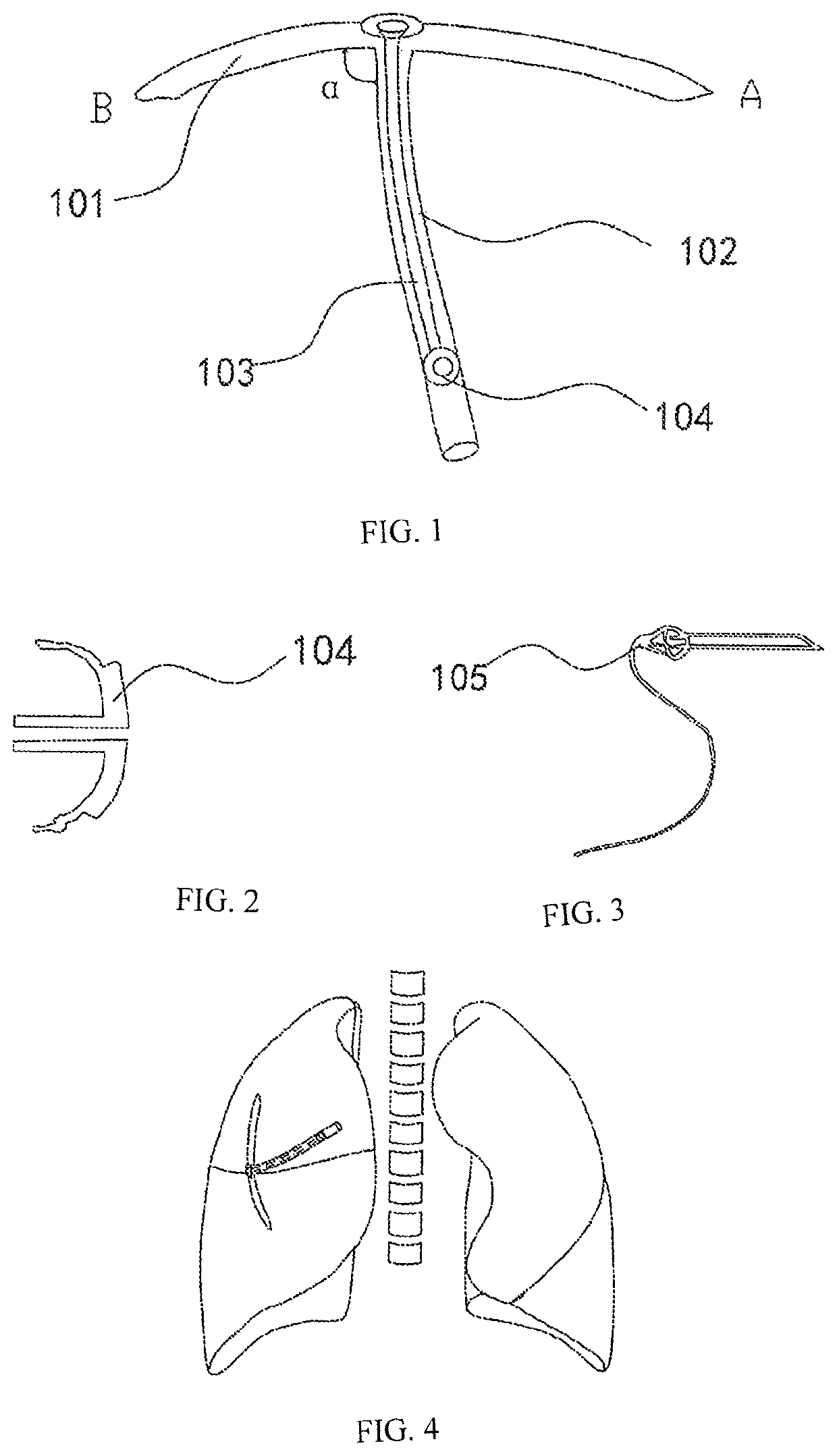 Method for precise localization and treatment of a target site and a medical auxiliary apparatus