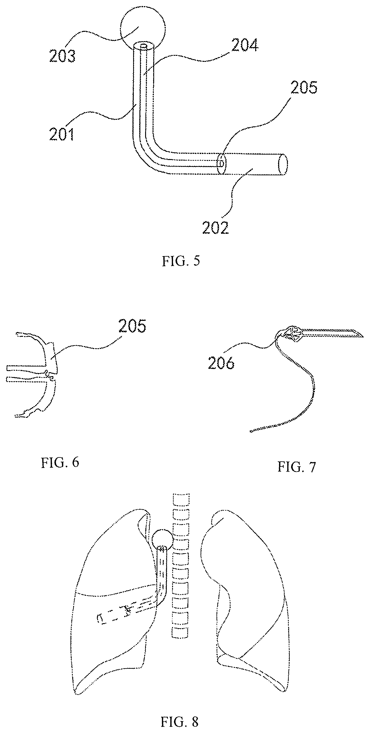 Method for precise localization and treatment of a target site and a medical auxiliary apparatus