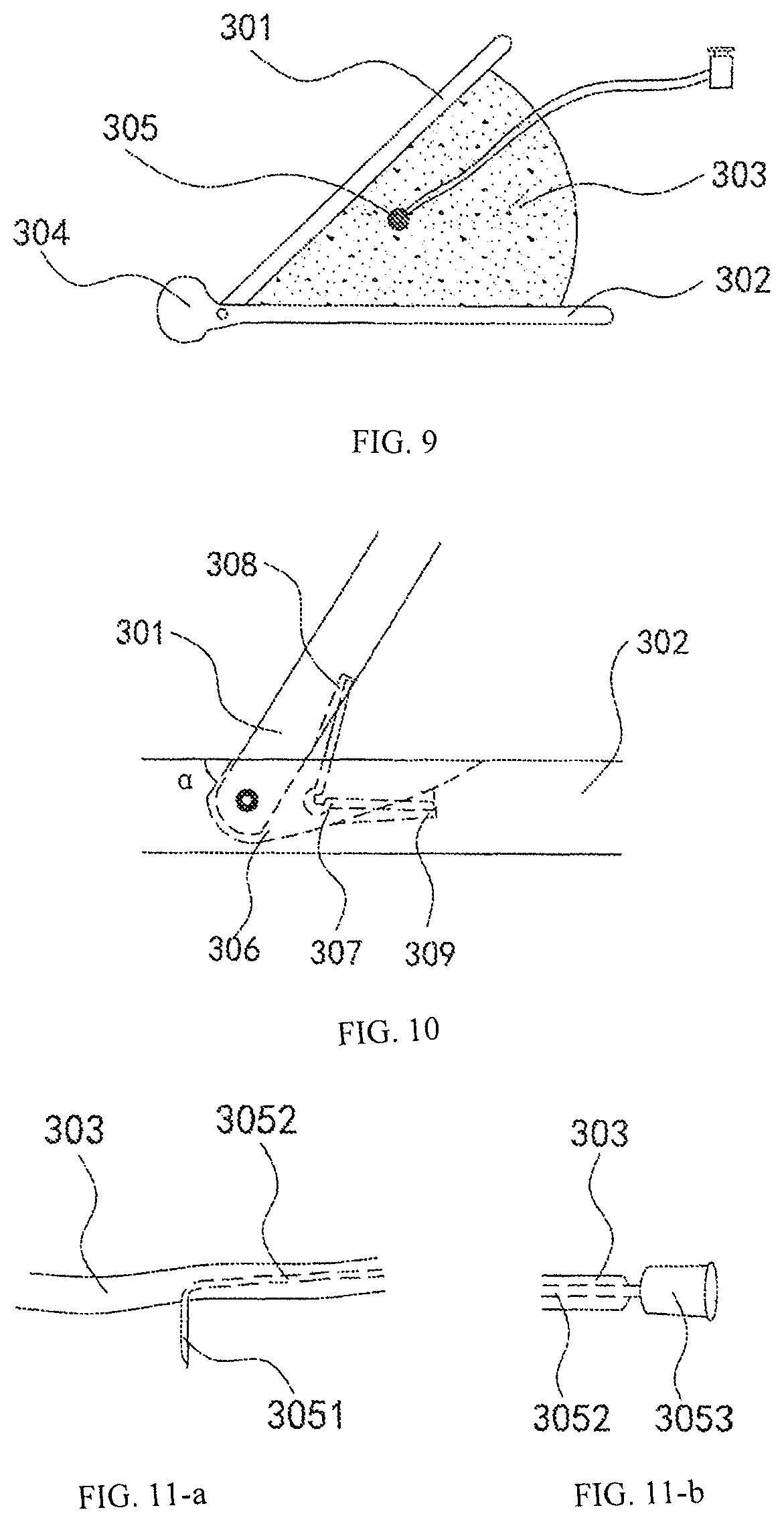 Method for precise localization and treatment of a target site and a medical auxiliary apparatus