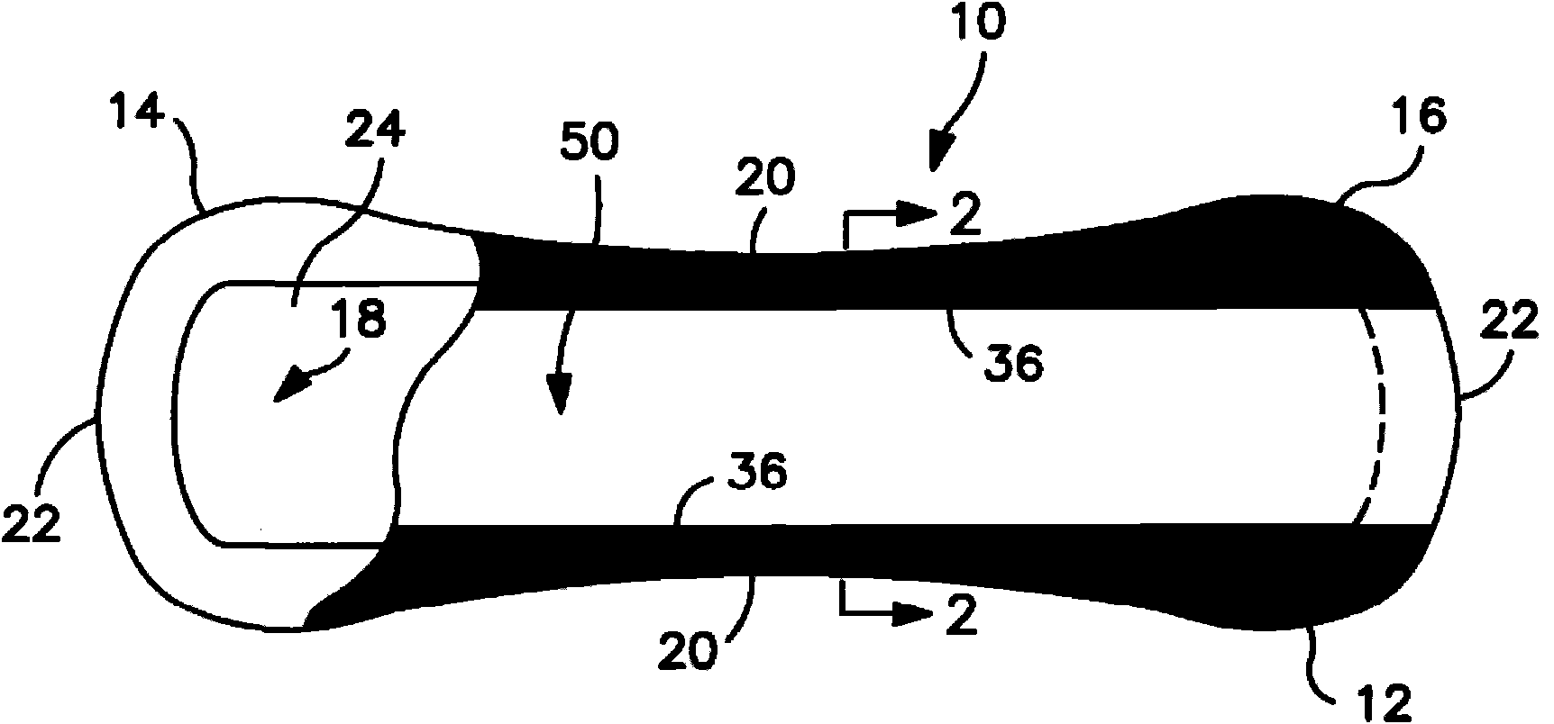 Zoned application of decolorizing composition for use in absorbent articles