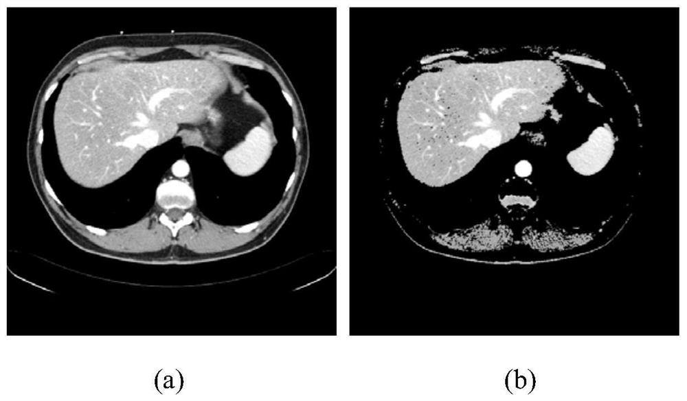 An Automatic Liver Segmentation Method for Abdominal CT Sequence Images Based on Level Set and Shape Descriptor