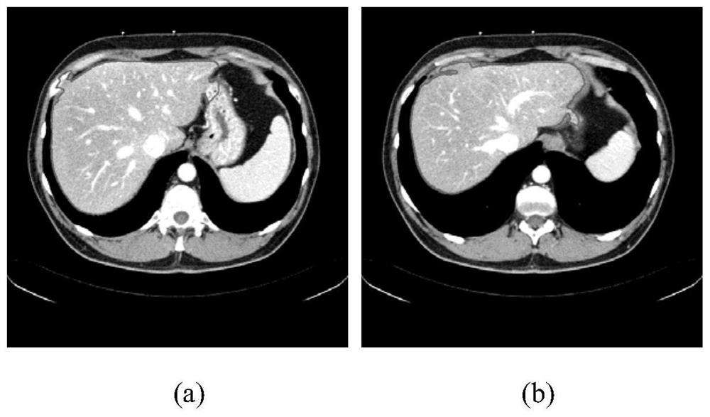 An Automatic Liver Segmentation Method for Abdominal CT Sequence Images Based on Level Set and Shape Descriptor