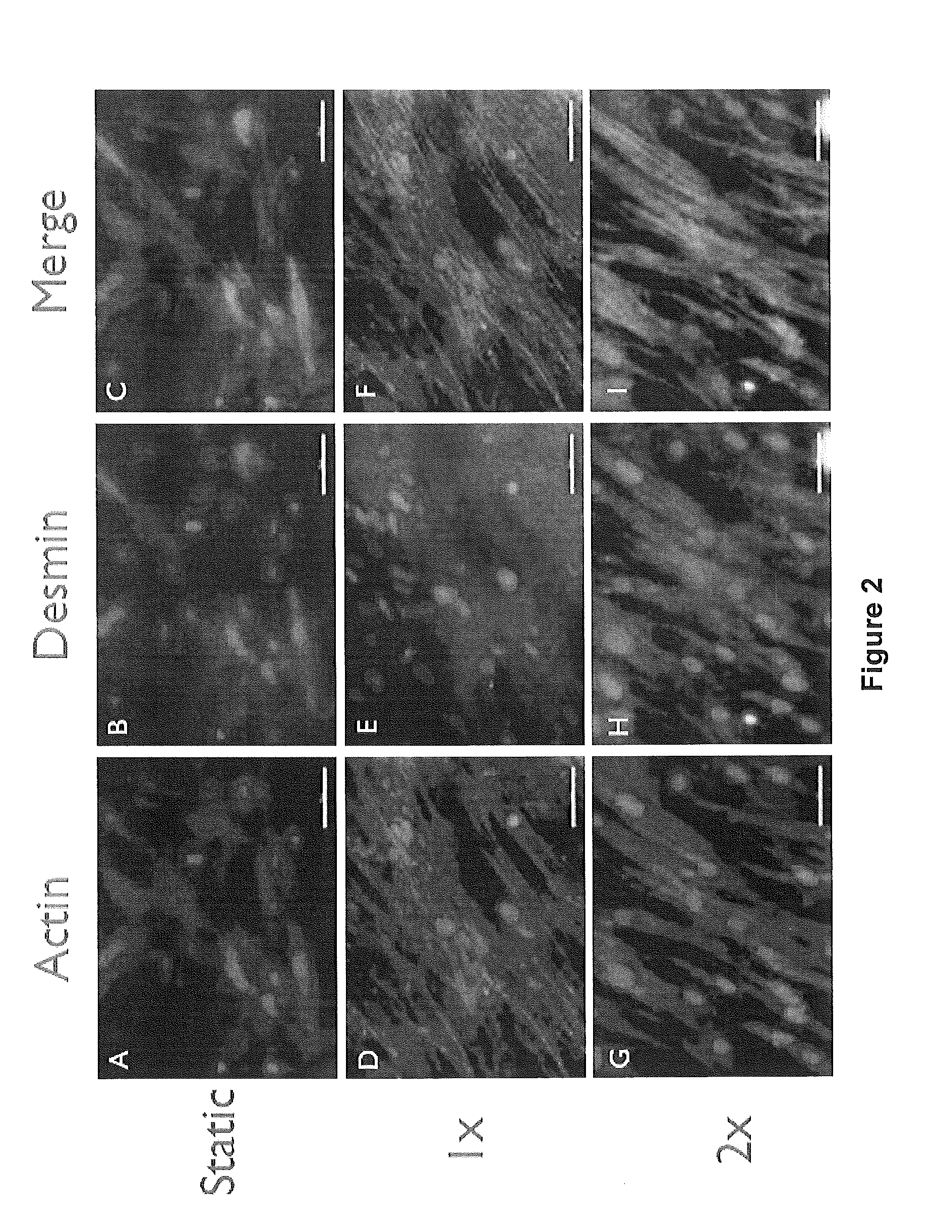 Methods for making a tissue engineered muscle repair (TEMR) construct in vitro for implantation in vivo