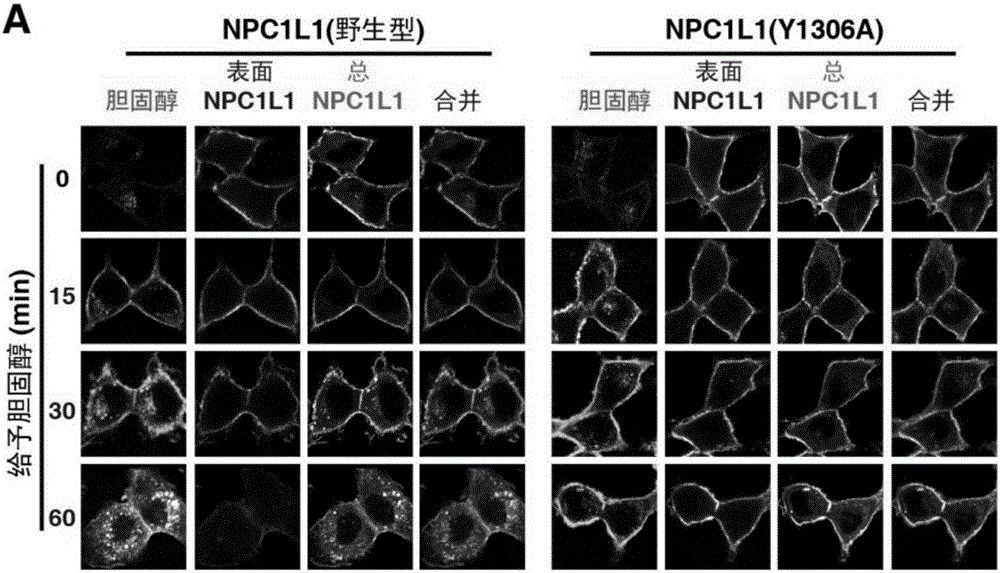 A key protein numb for hepatic and intestinal cholesterol absorption and its use