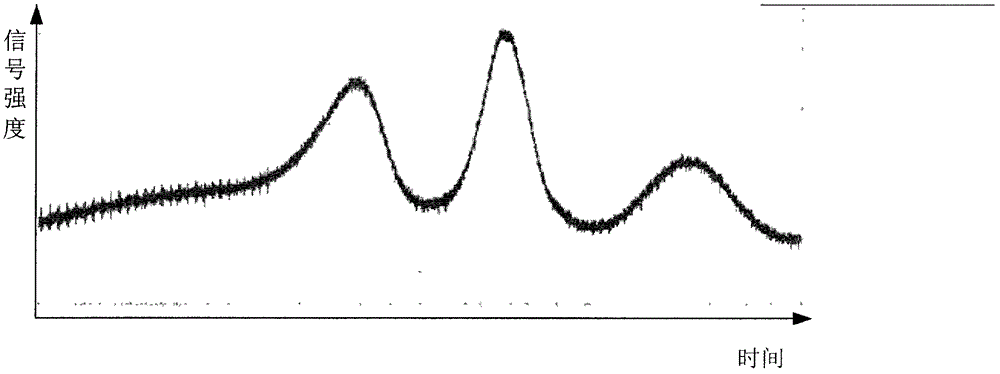 Conductively cooled high-repetition single frequency Nd: YAG Laser