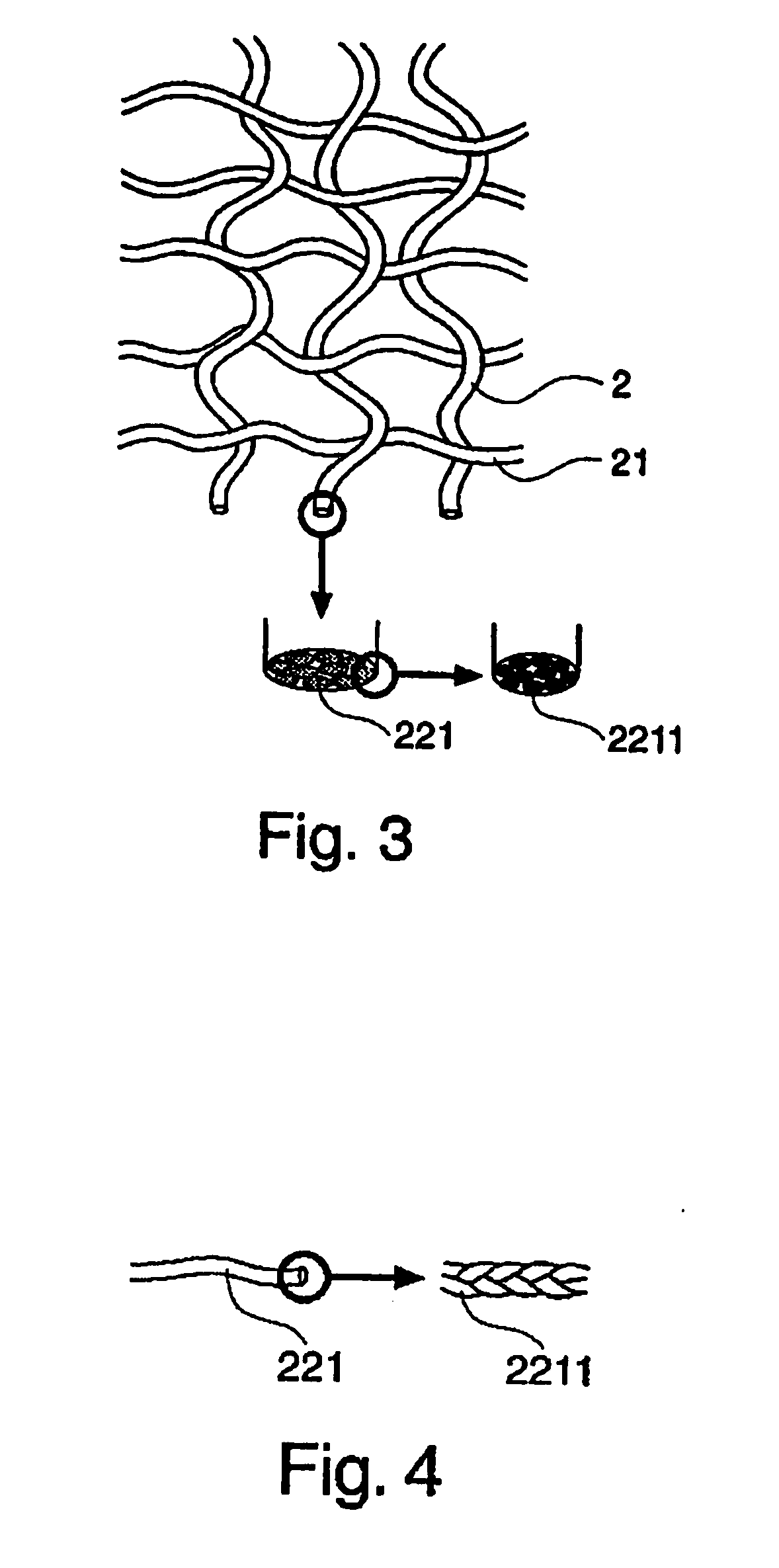 Synthetic, bioabsorbable polymer materials and implants