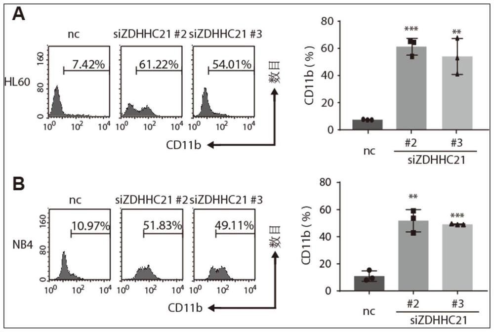 Application of zdhhc21 gene in preparation of medicine for inducing differentiation therapy of leukemia