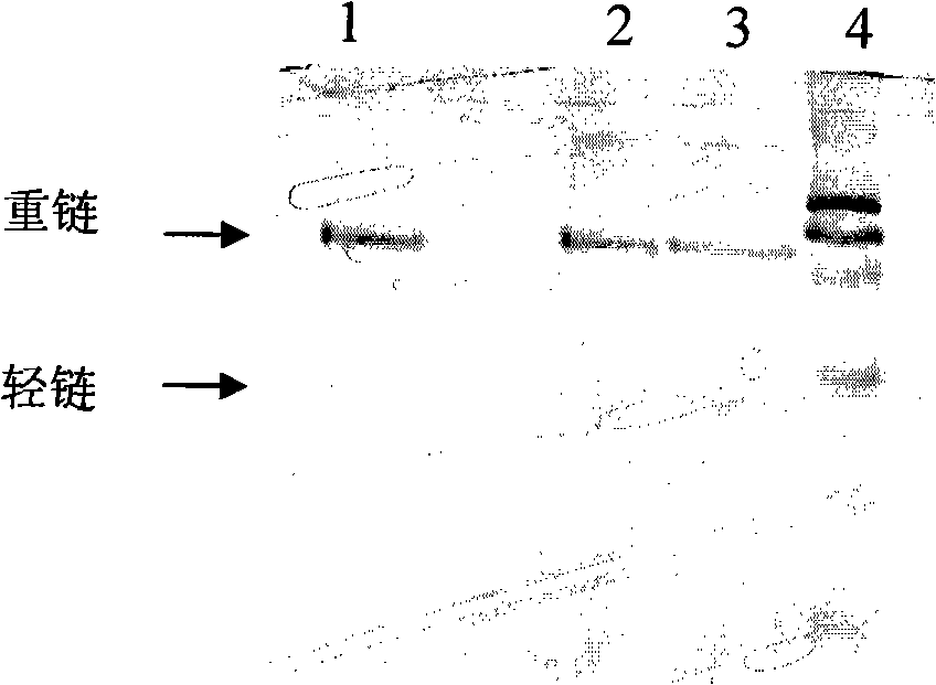 Anti-CD86 humanized monoclonal antibody