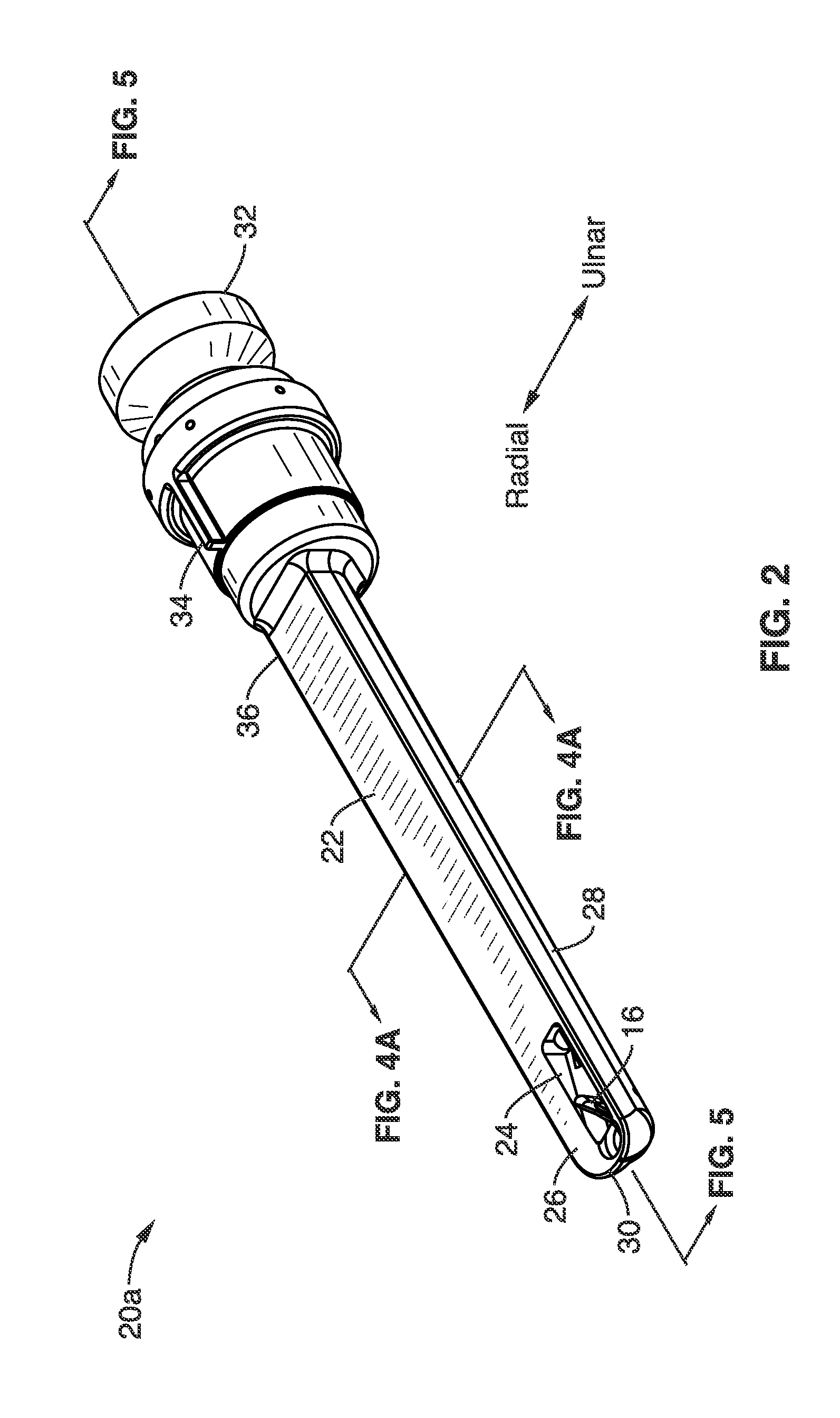 Method and apparatus for treatment of CTS using endoscopic carpal tunnel release