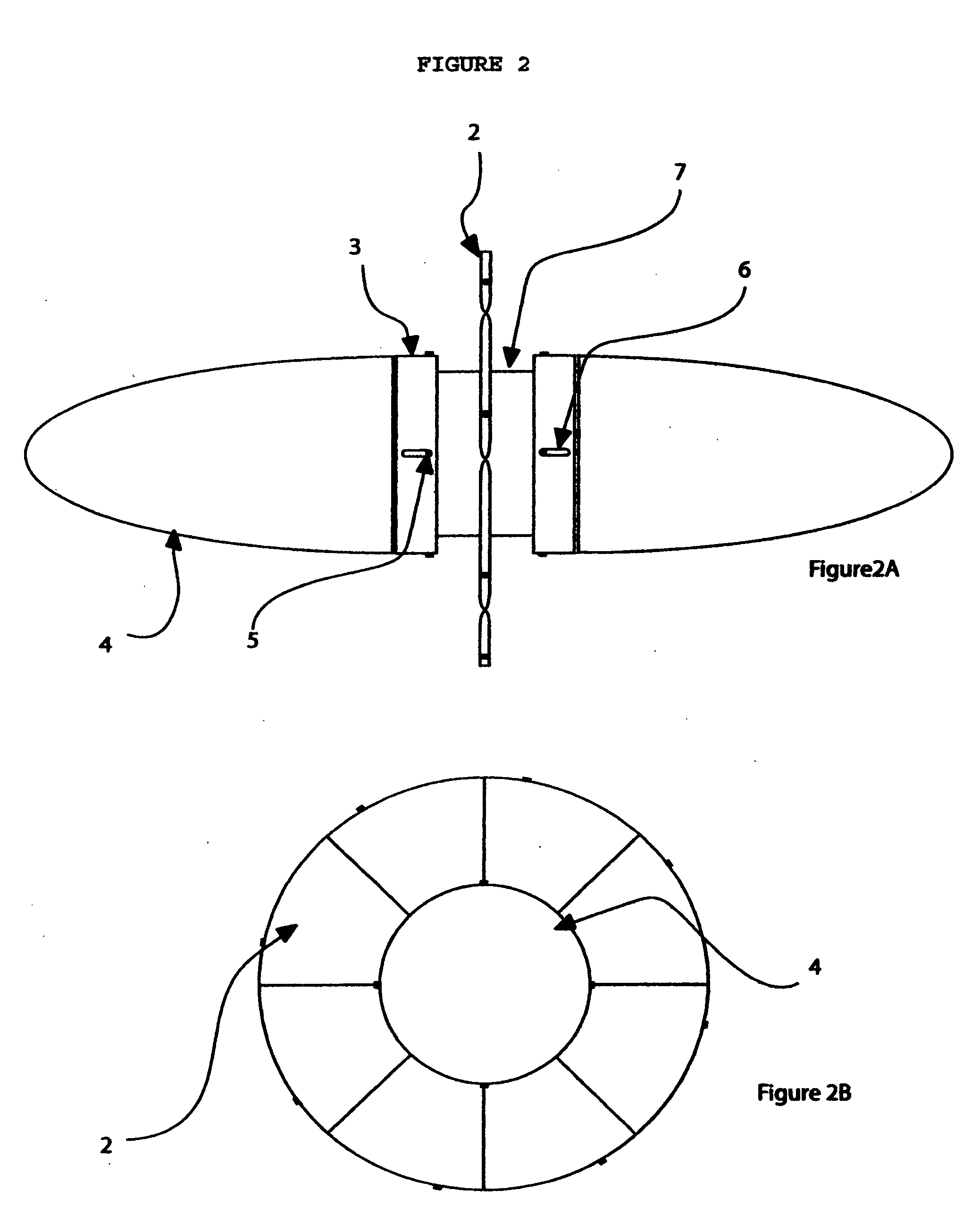 Ortiz turbine