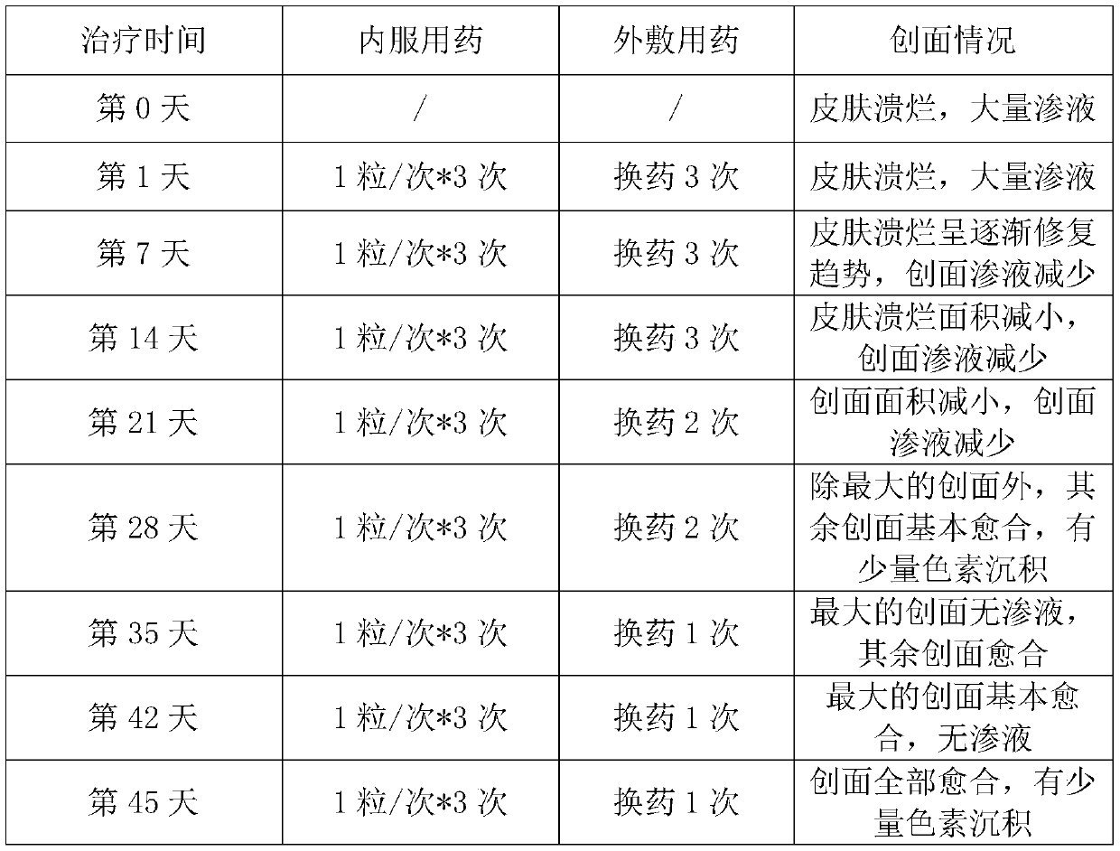 A combination drug for the treatment of diabetic refractory wound complications