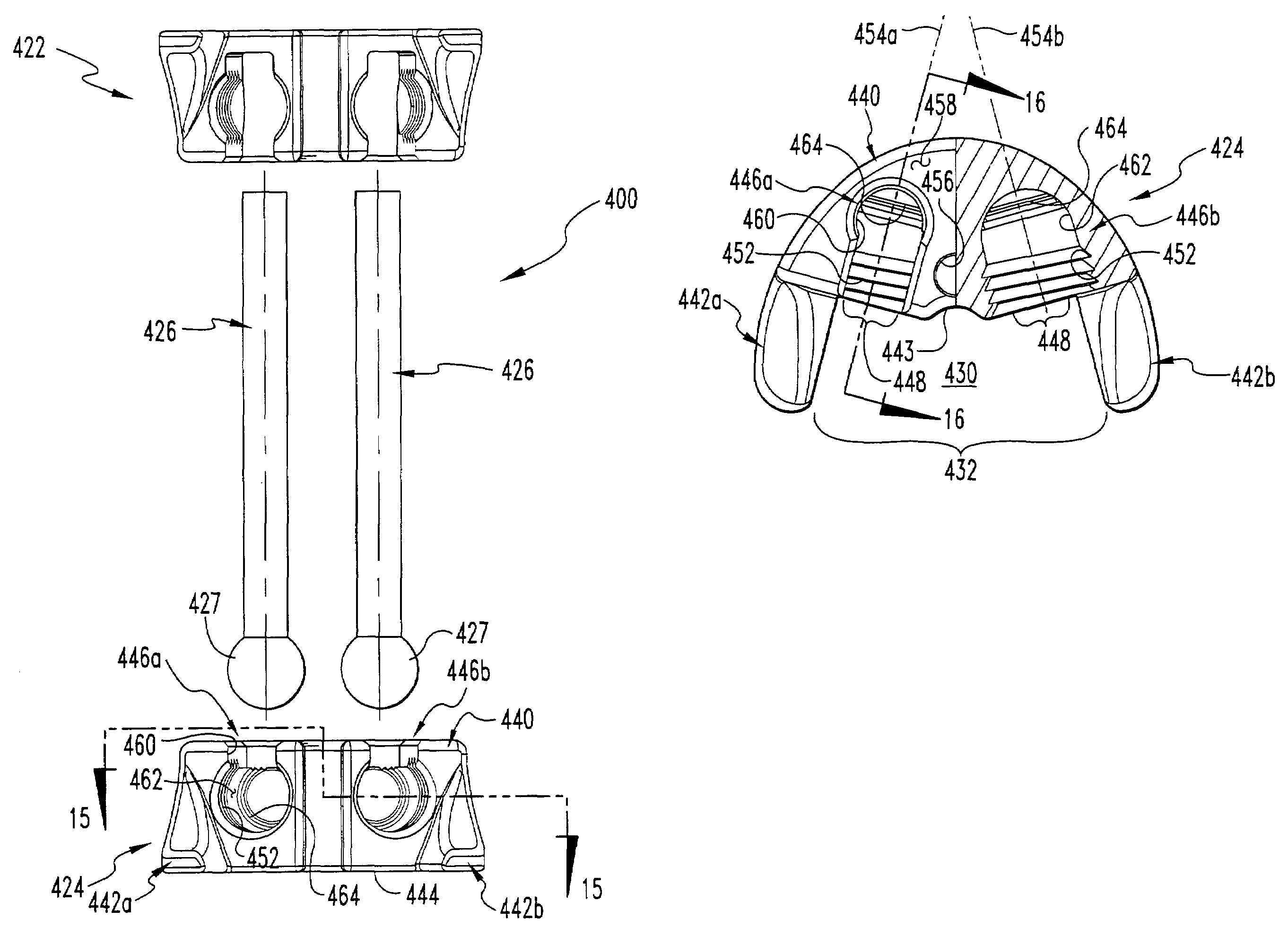 Apparatus and method for supporting vertebral bodies