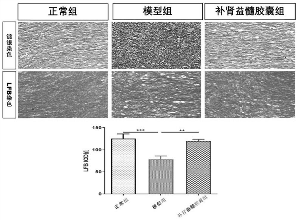 Application of kidney and marrow-tonifying capsule in treatment of optic neuritis