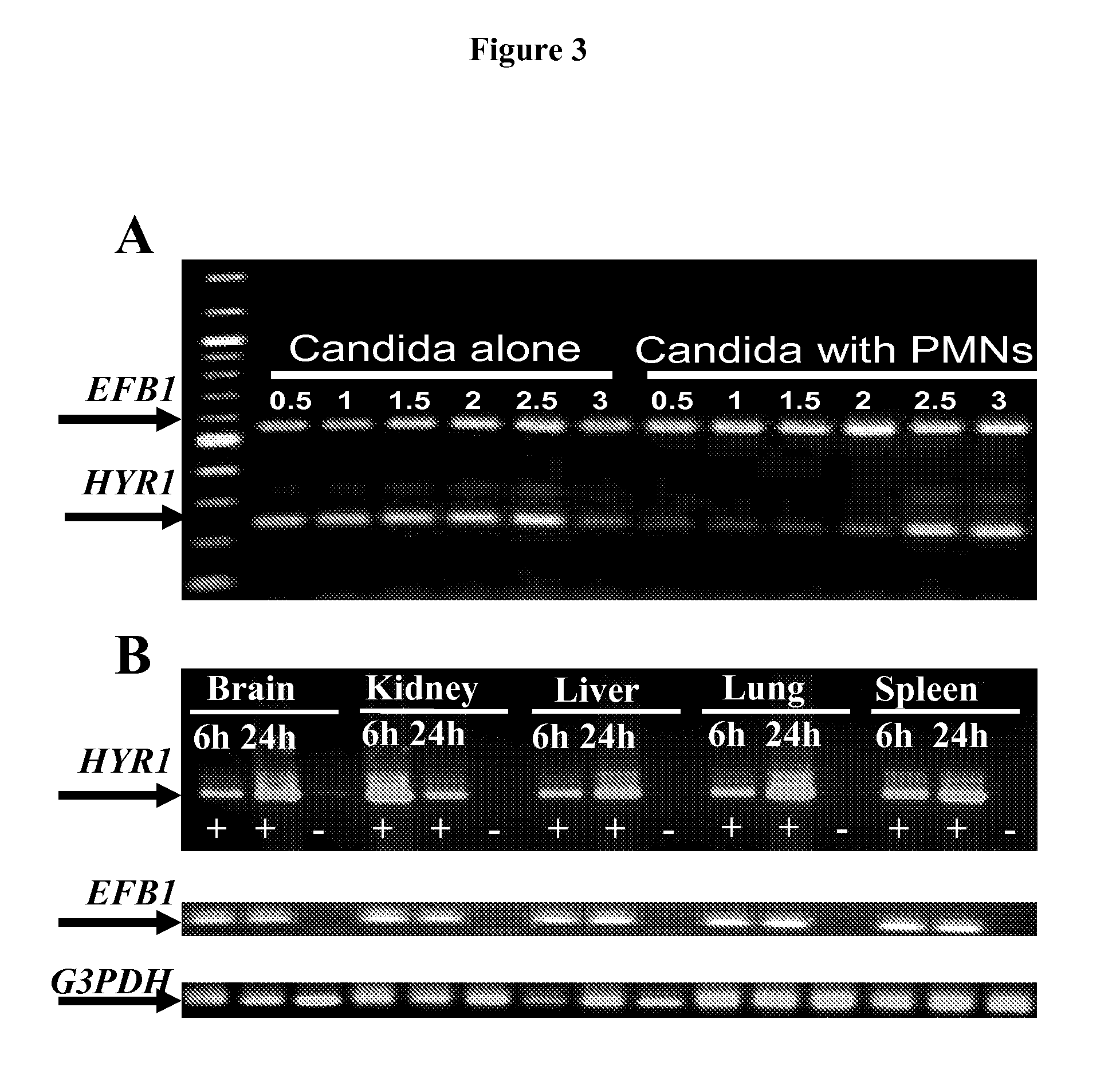 HYR1 as a target for active and passive immunization against <i>Candida </i>