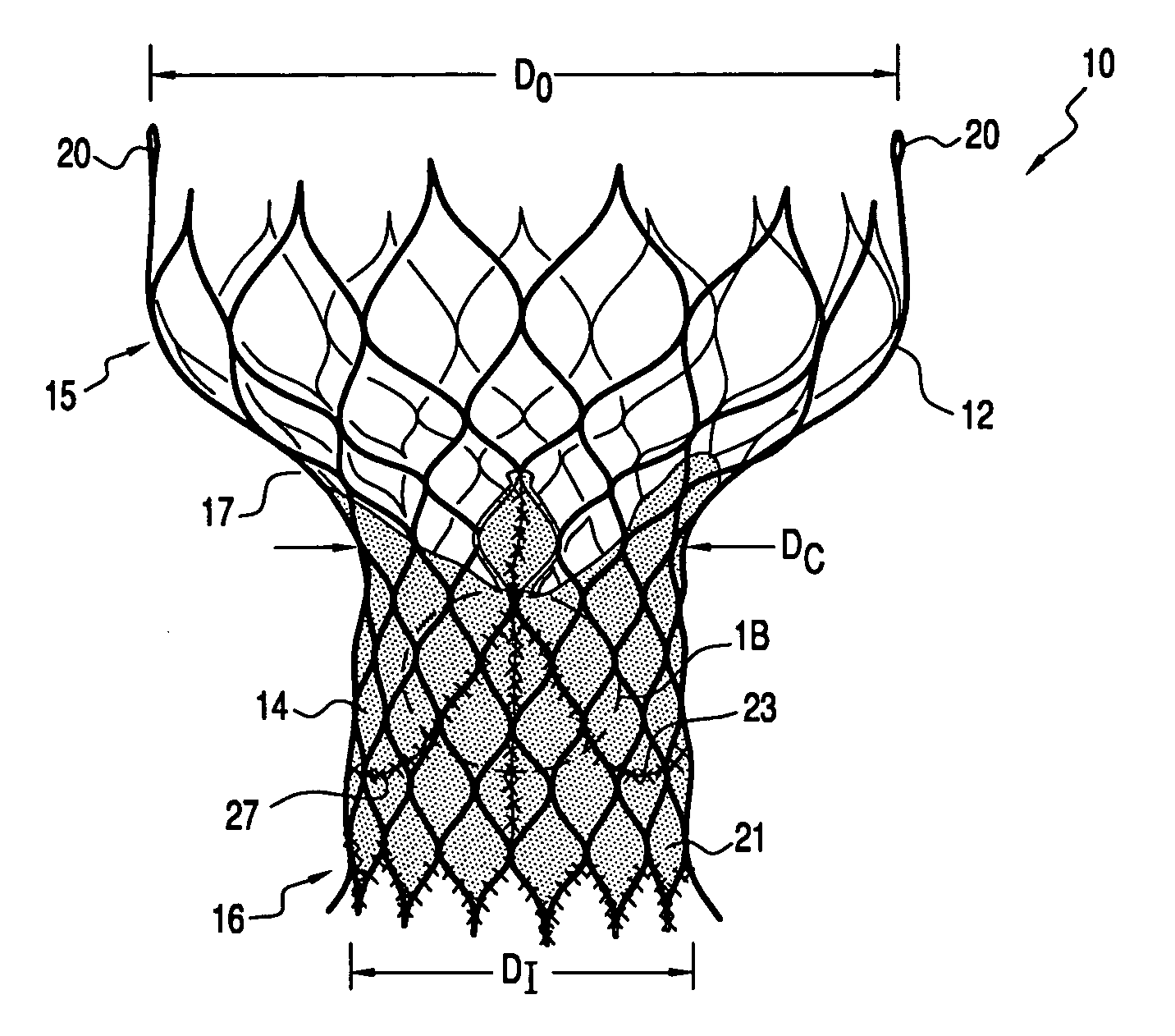 Heart valve prosthesis and methods of manufacture and use