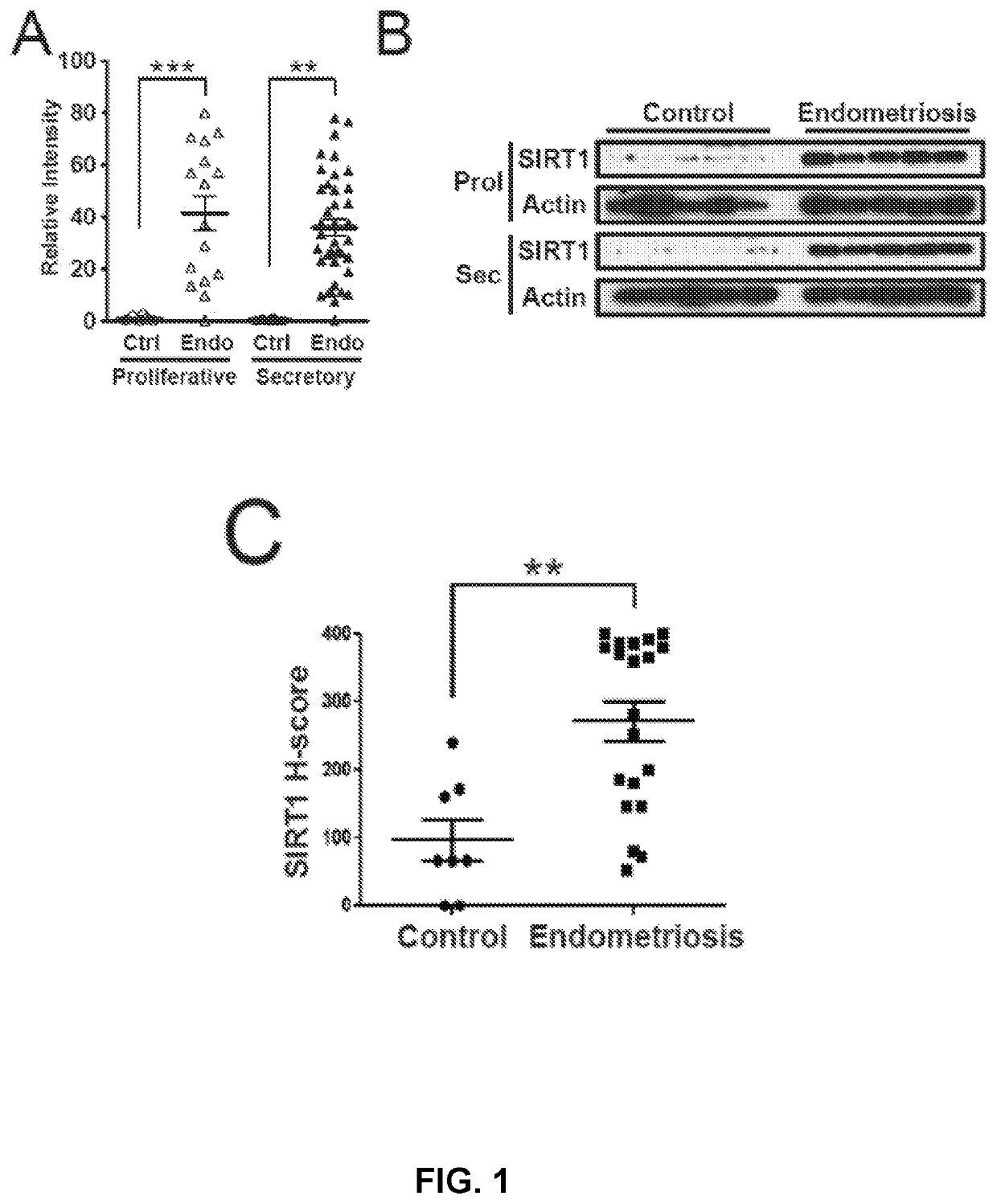 Methods and compositions for sirt1 expression as a marker for endometriosis and subfertility