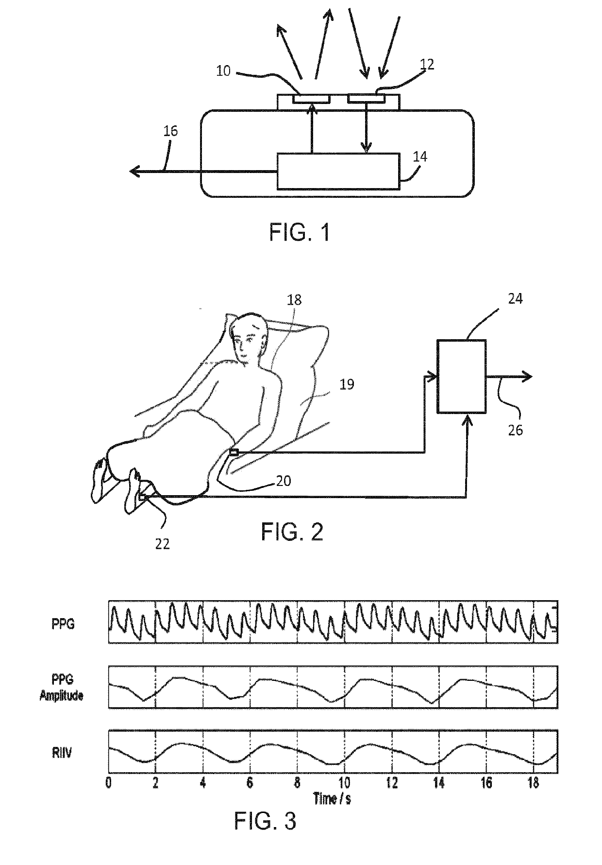 A sensor system and method for determining a breathing type