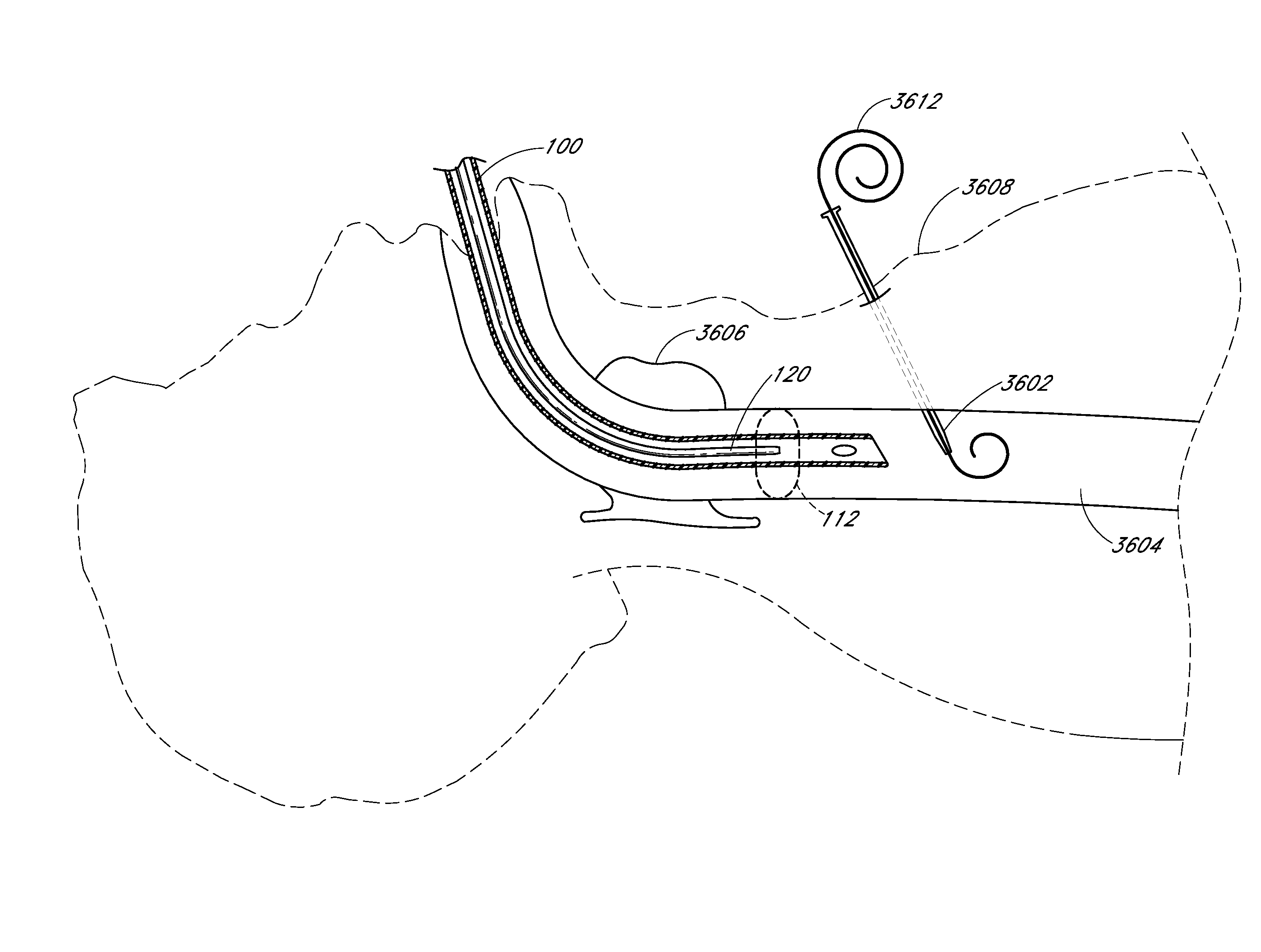 Methods for tracheostomy visualization