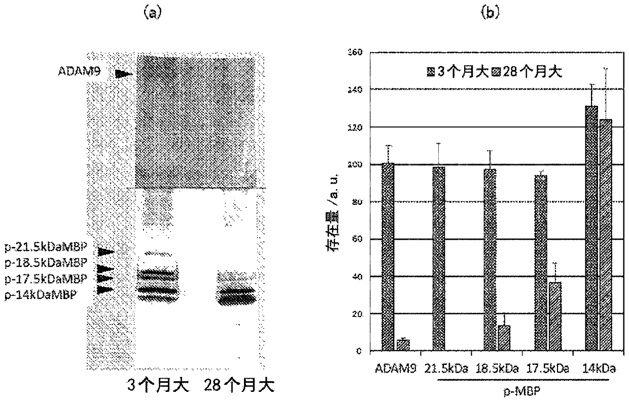 Composition for treatment and/or prevention of alzheimer's disease