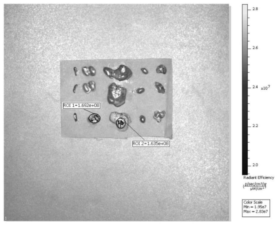 Microneedle capable of controllably releasing medicine and preparation method of microneedle