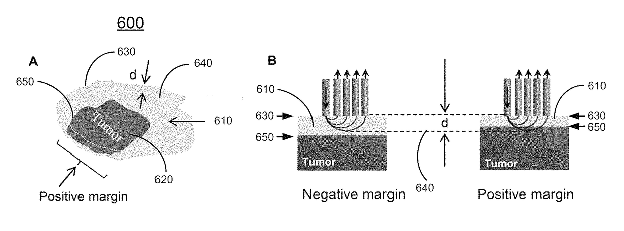 Methods and systems for three-dimensional real-time intraoperative surgical margin evaluation of tumor tissues