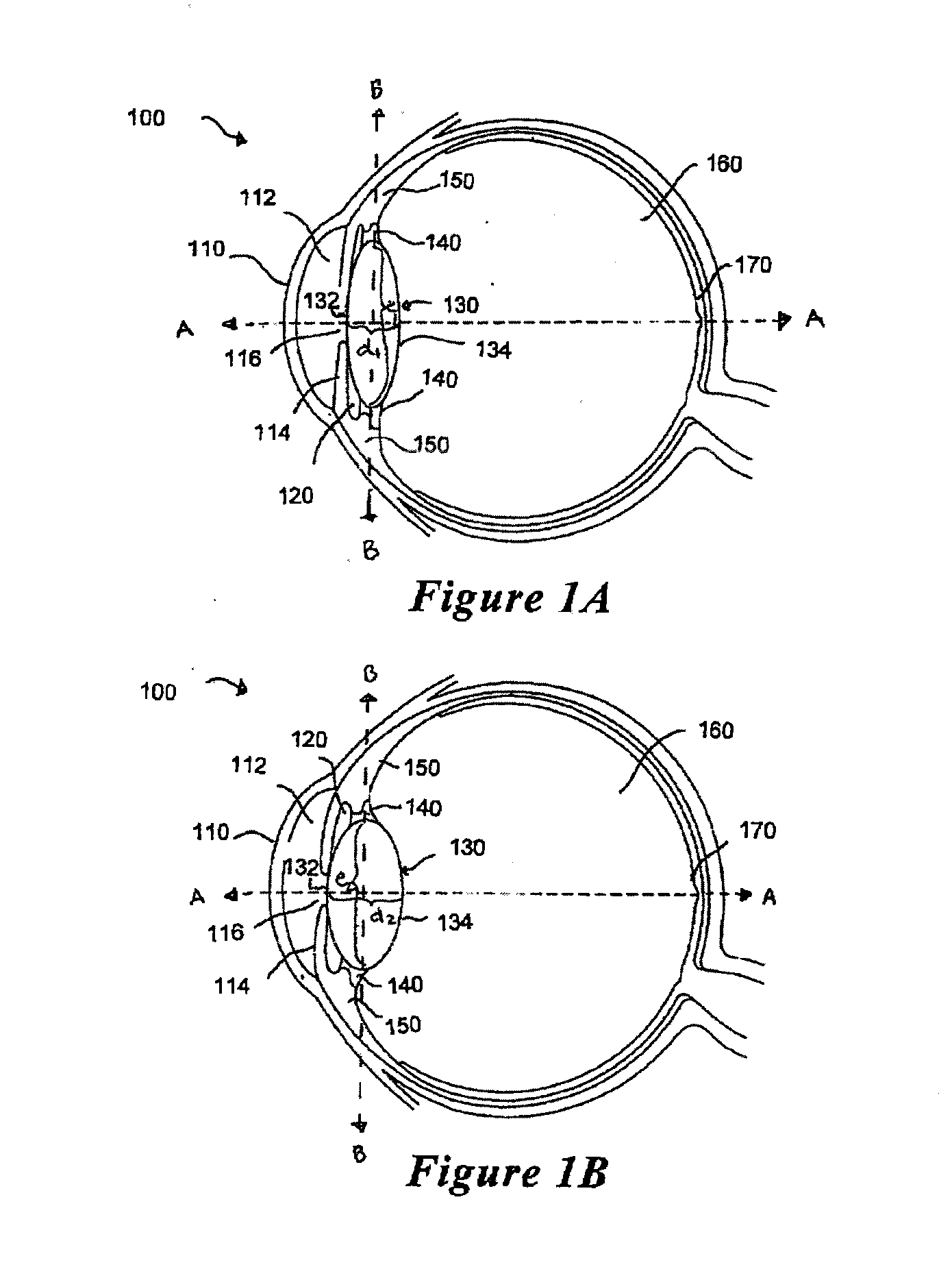 Method and system for adjusting the refractive power of an implanted intraocular lens