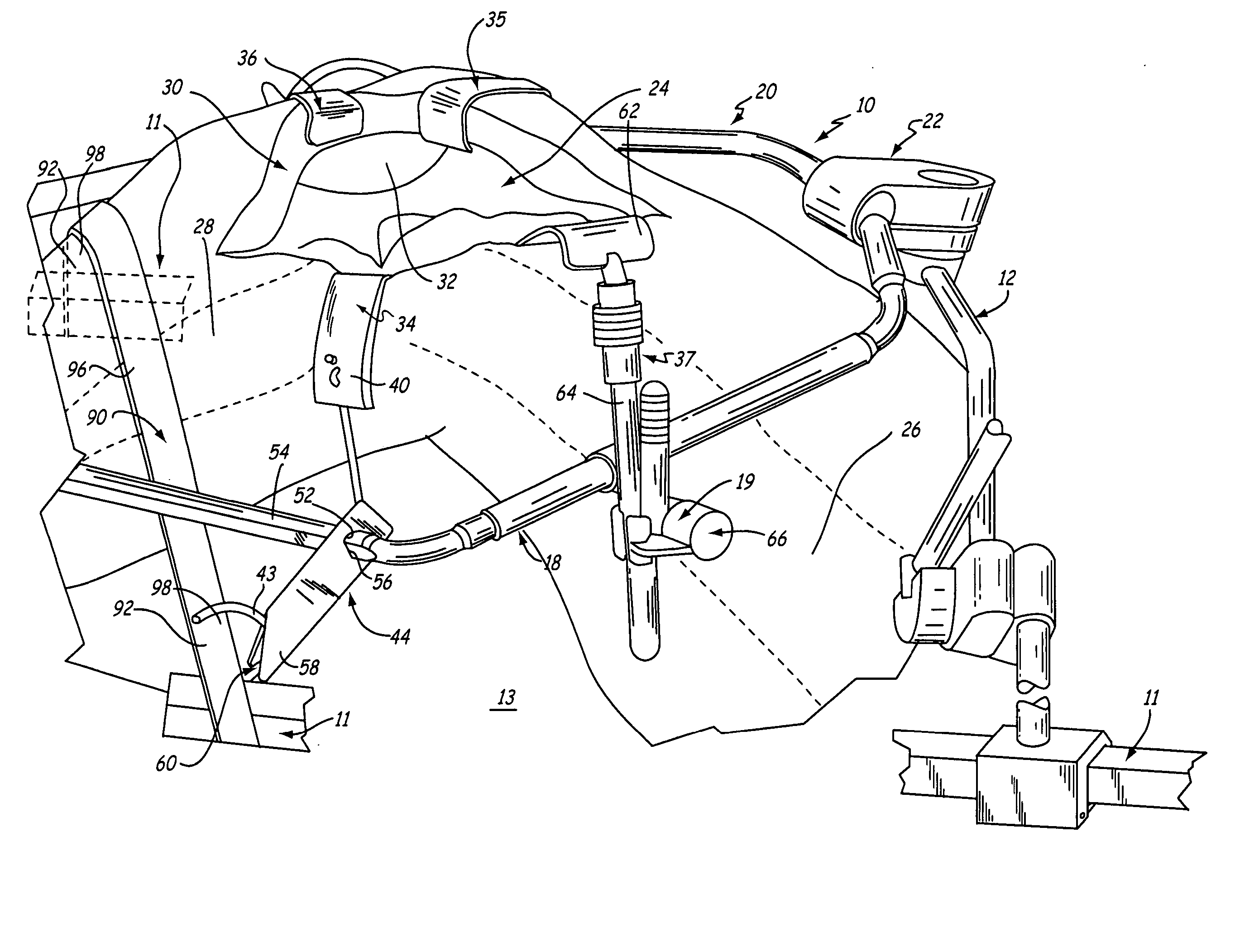 Method for knee-joint surgery