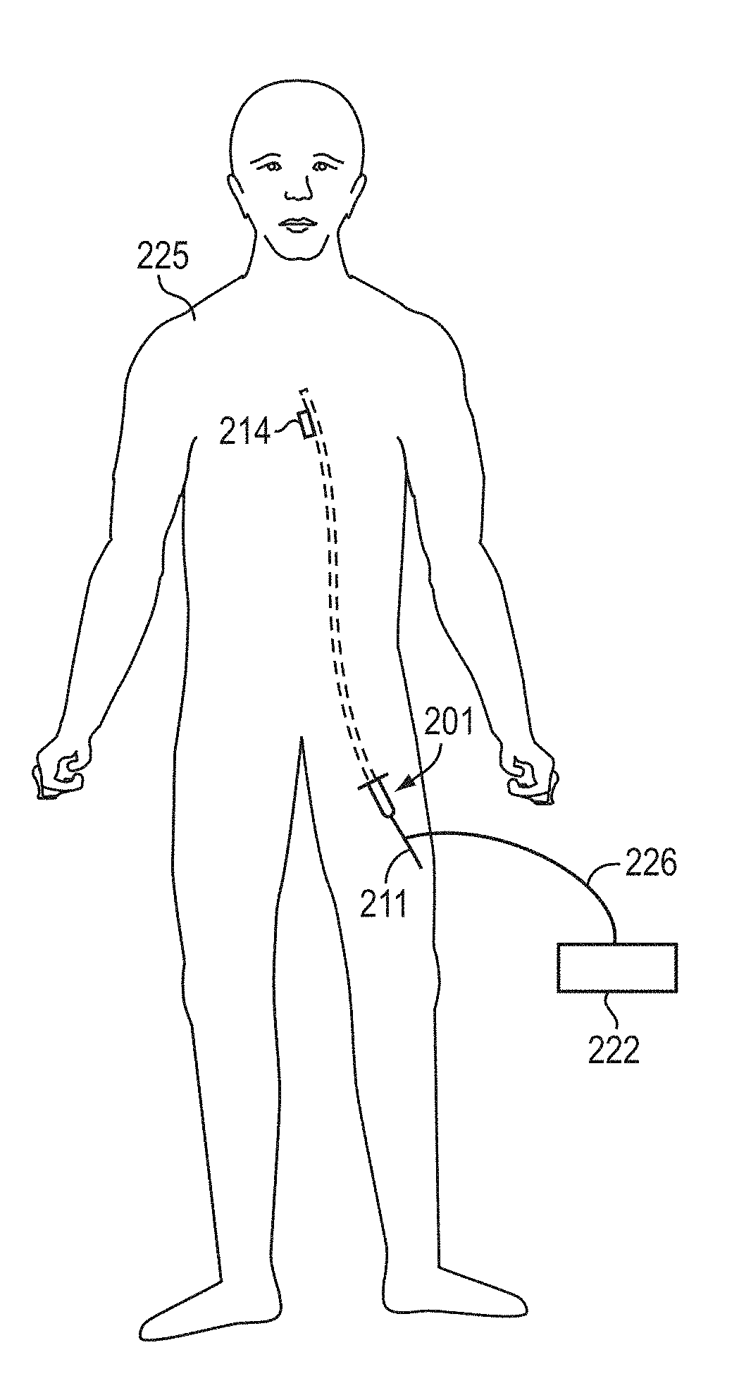 Multimodal Imaging System, Apparatus, and Methods